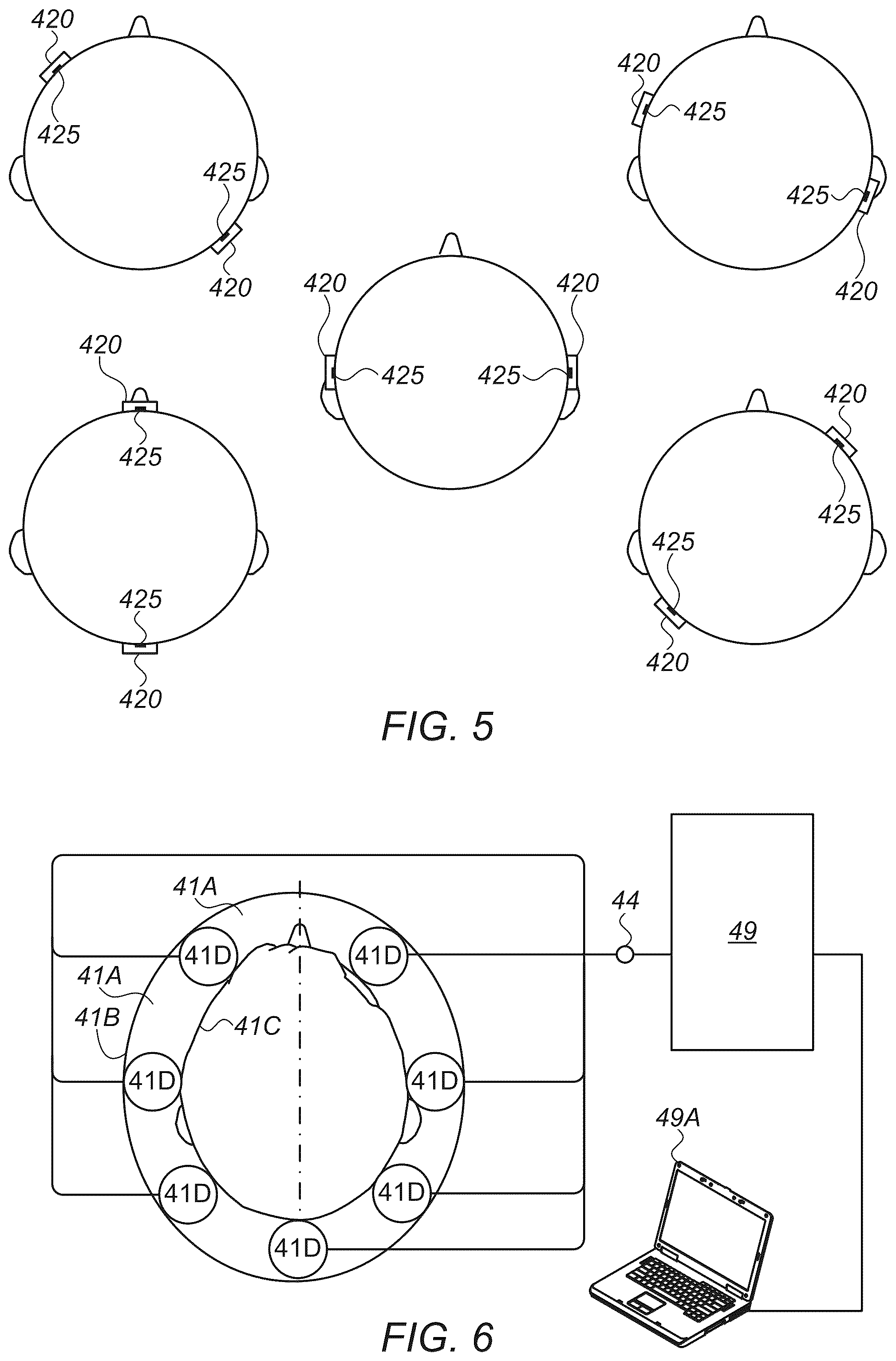 Patent US12426849 Figure 4 – Method and apparatus for noninvasive absolute (mean) intracranial pressure (A-ICP) measurement and/or monitoring