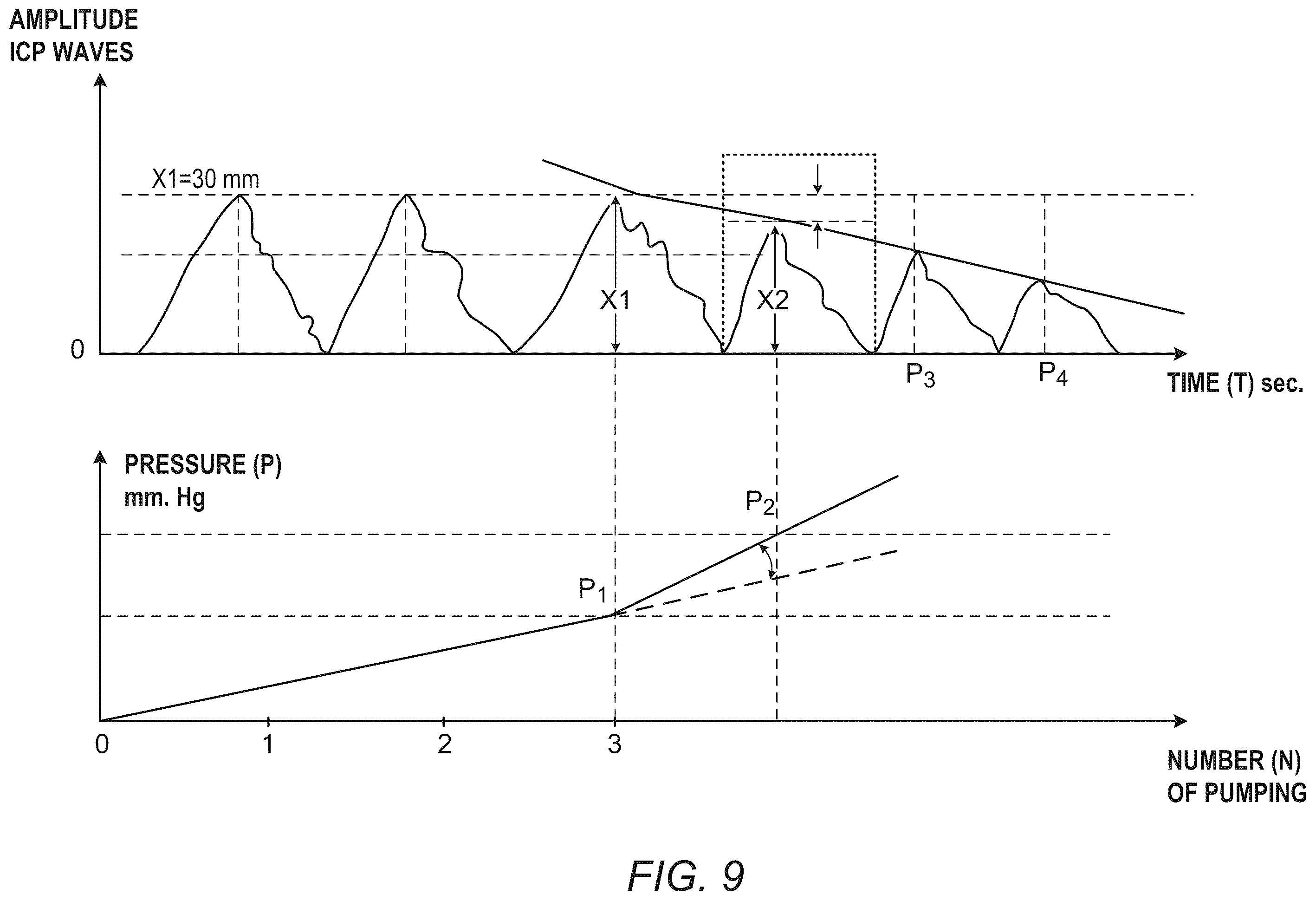 Patent US12426849 Figure 7 – Method and apparatus for noninvasive absolute (mean) intracranial pressure (A-ICP) measurement and/or monitoring
