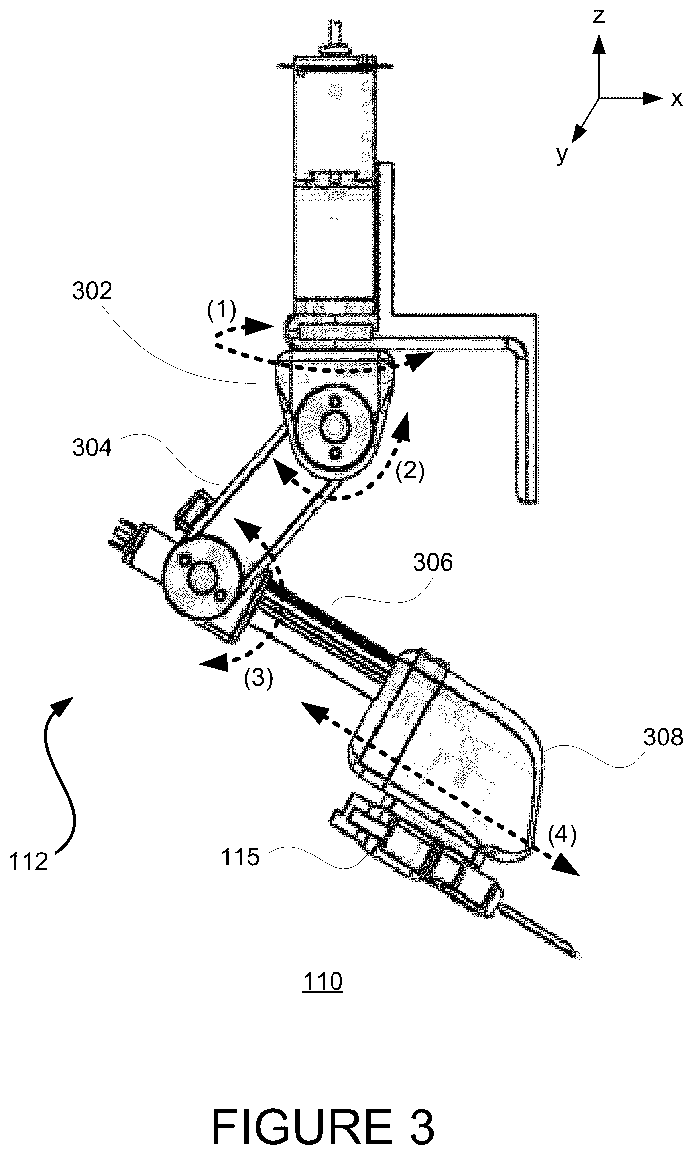 Patent US12426850 Figure 3 – Ultrasound-guided alignment and insertion of percutaneous cannulating instruments