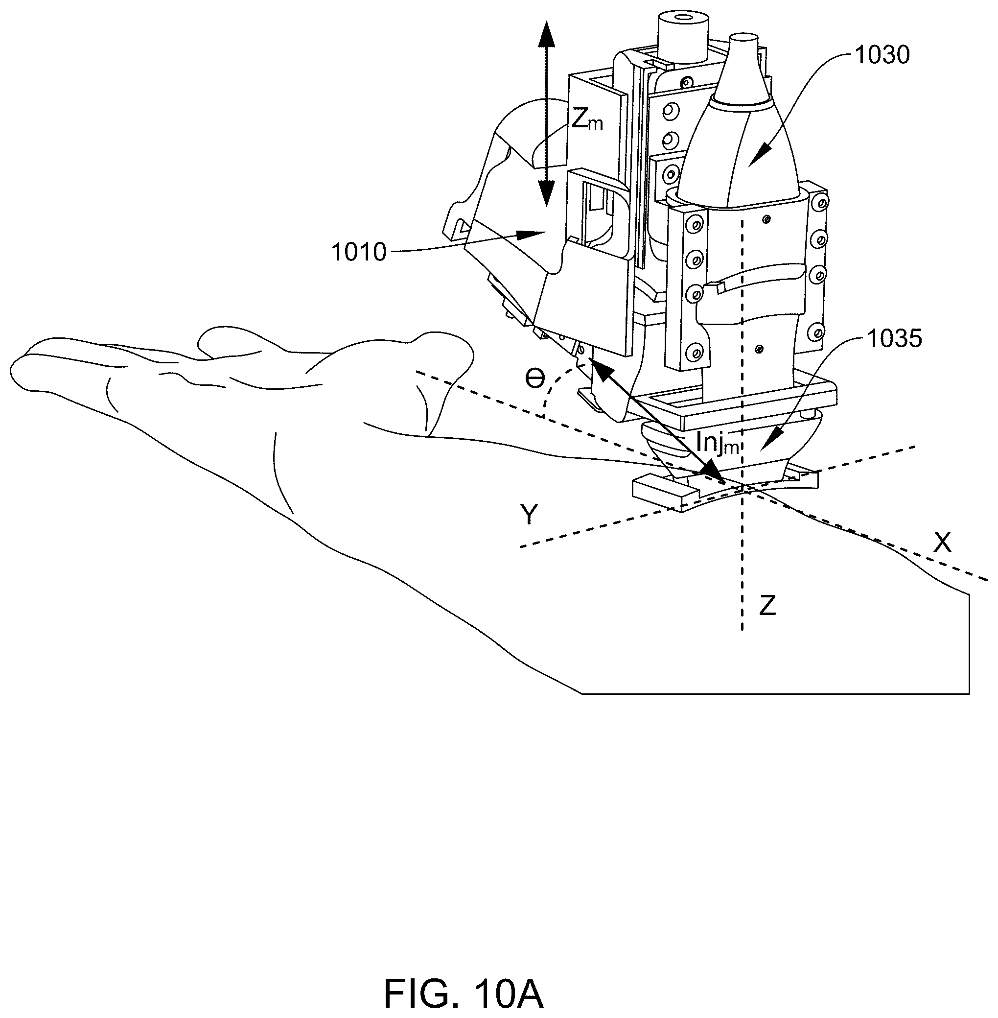Patent US12426850 Figure 12 – Ultrasound-guided alignment and insertion of percutaneous cannulating instruments