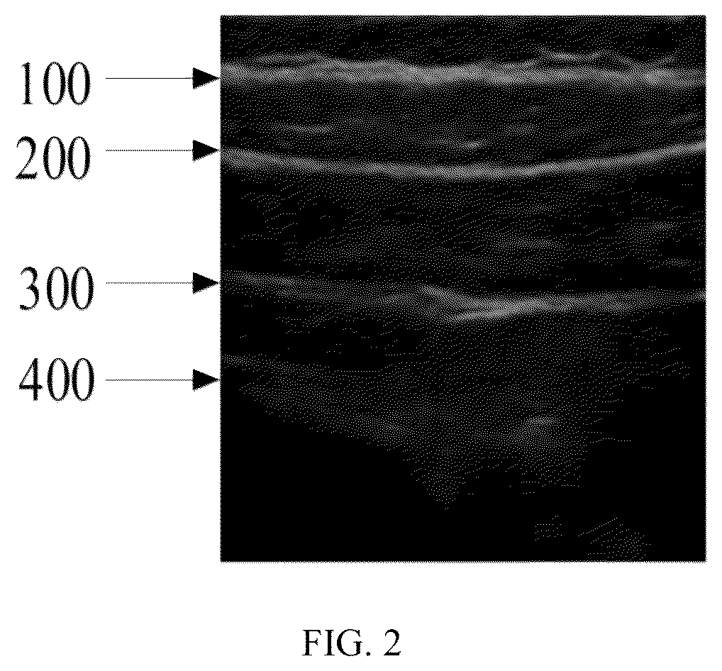Patent US12426851 Figure 2 – Method, system, apparatus and medium for monitoring abdominal respiration based on ultrasound image