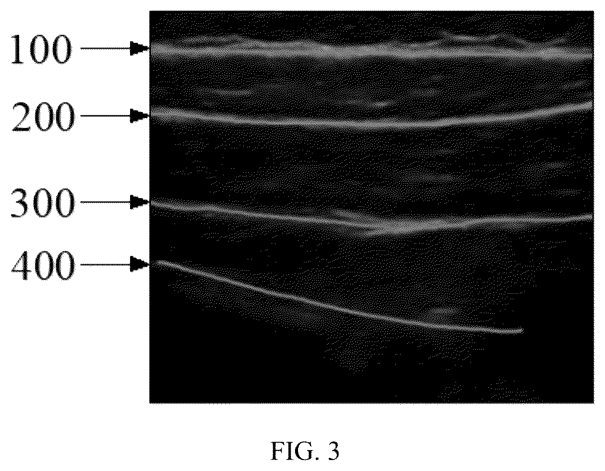 Patent US12426851 Figure 3 – Method, system, apparatus and medium for monitoring abdominal respiration based on ultrasound image