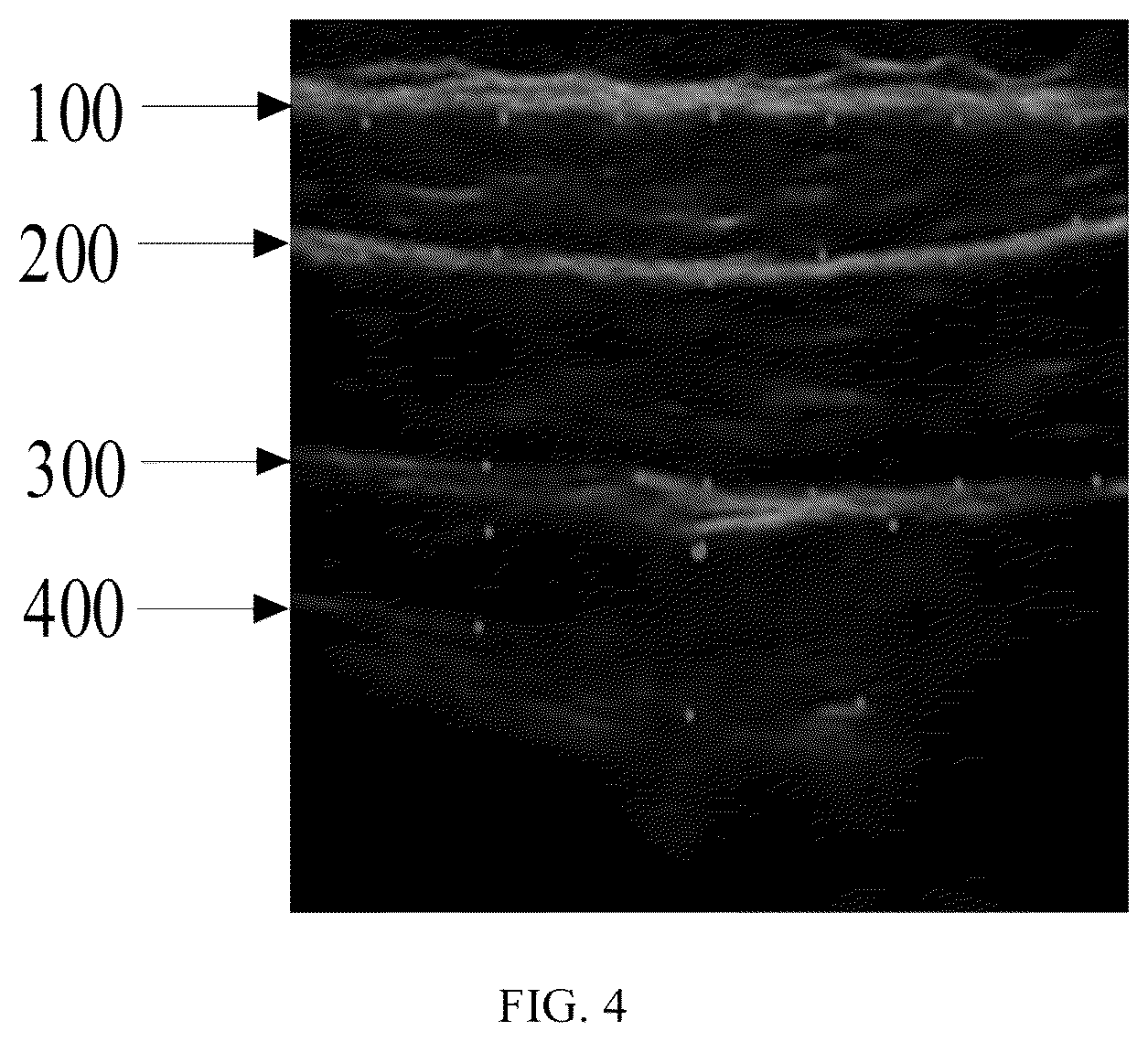 Patent US12426851 Figure 4 – Method, system, apparatus and medium for monitoring abdominal respiration based on ultrasound image