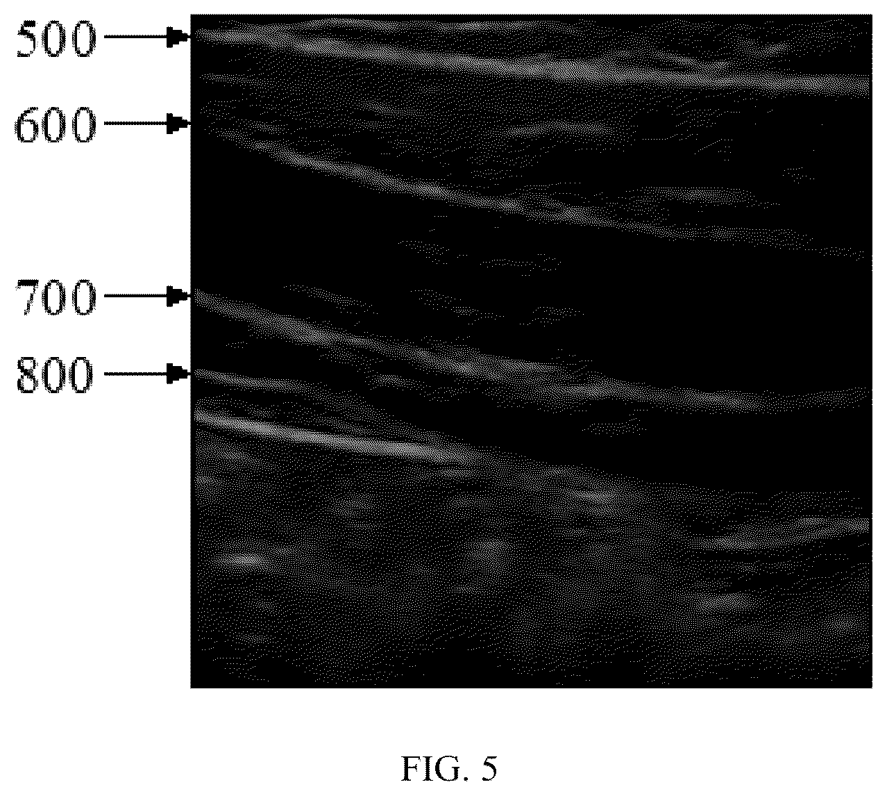 Patent US12426851 Figure 5 – Method, system, apparatus and medium for monitoring abdominal respiration based on ultrasound image