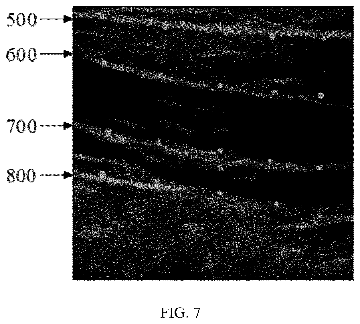 Patent US12426851 Figure 7 – Method, system, apparatus and medium for monitoring abdominal respiration based on ultrasound image