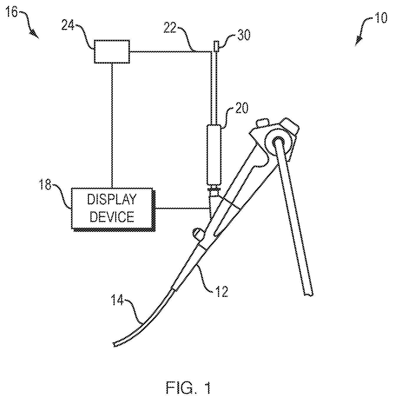 Patent US12426853 — Orientation pins for device using radial ultrasound — Figure 1