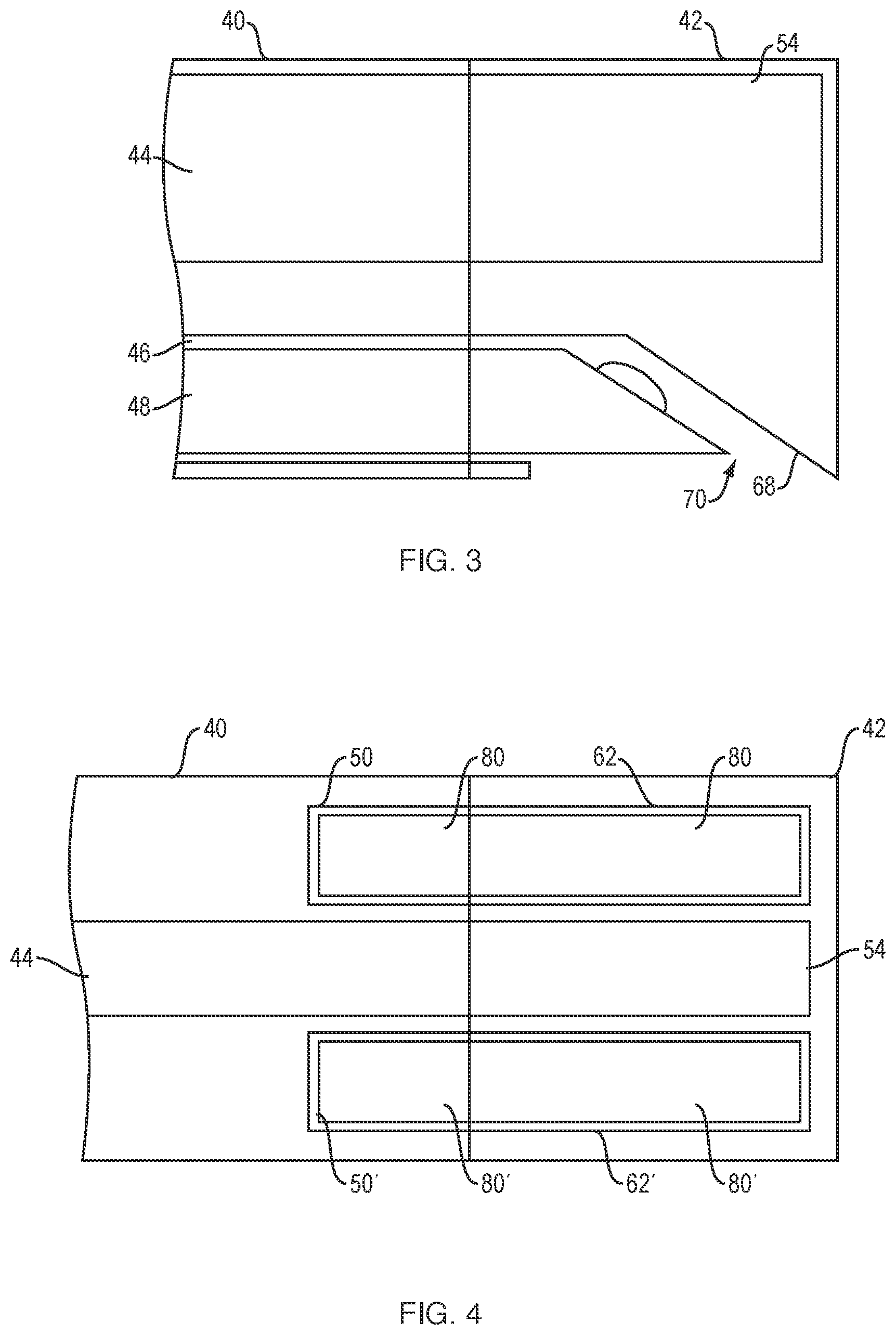Patent US12426853 Figure 3 – Orientation pins for device using radial ultrasound