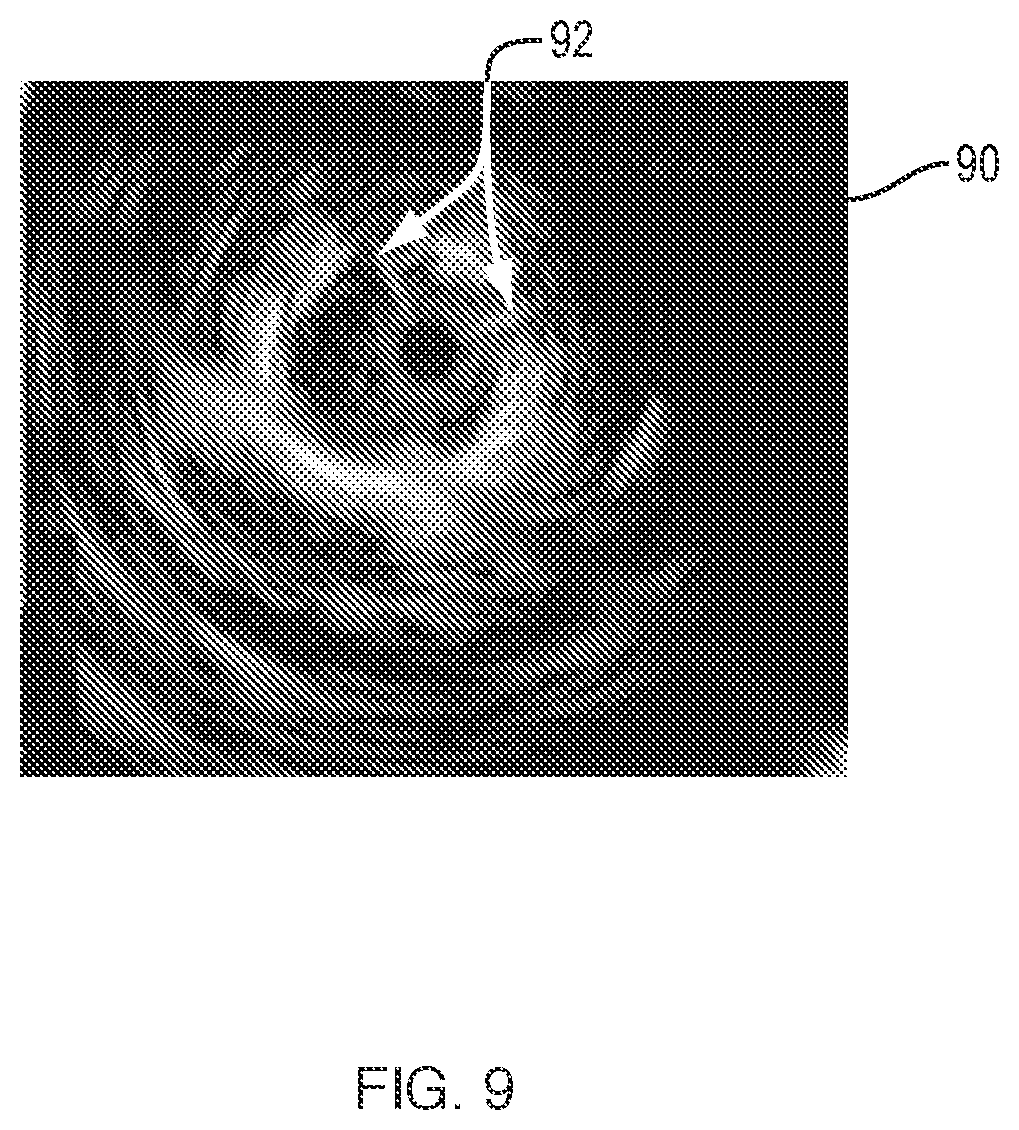 Patent US12426853 Figure 6 – Orientation pins for device using radial ultrasound