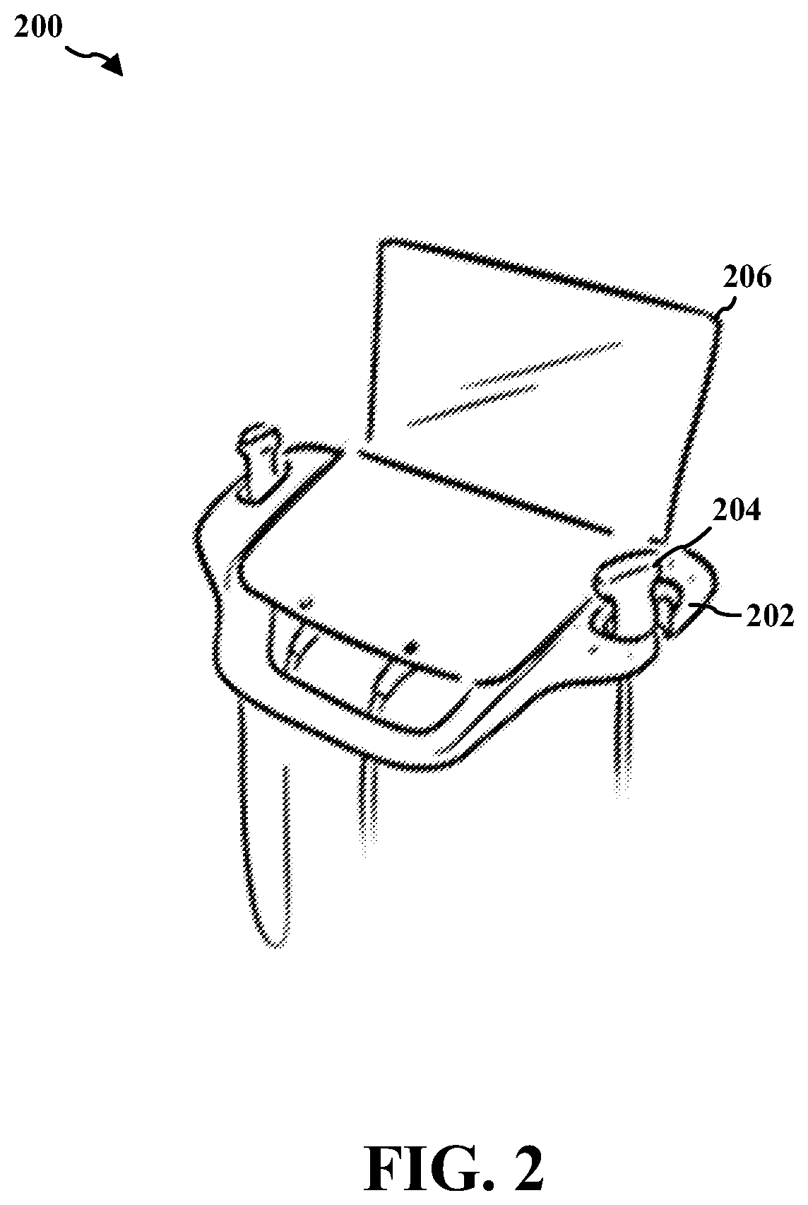 Patent US12426854 Figure 2 – Coordinating scanners in an ultrasound cart
