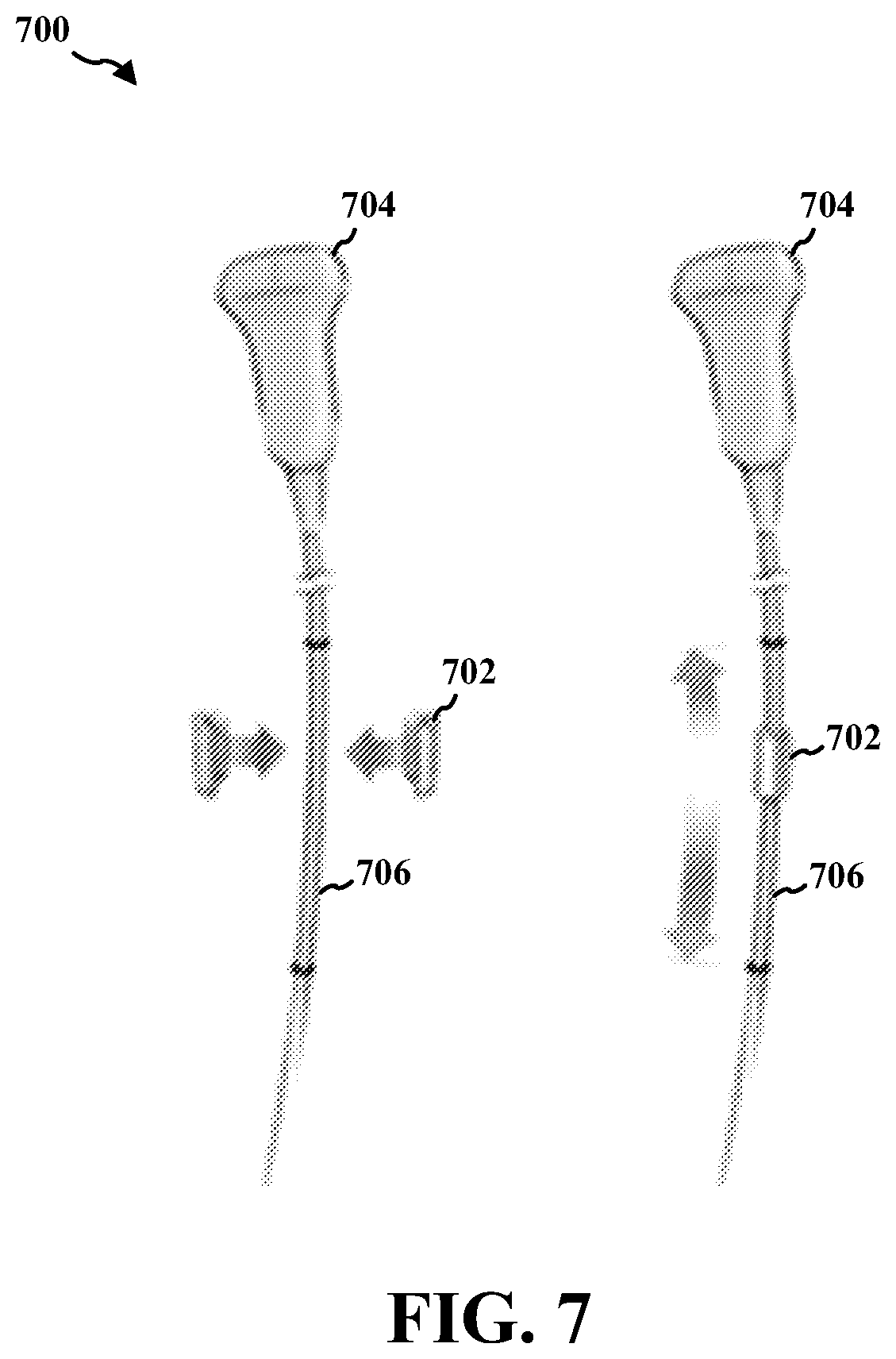 Patent US12426854 Figure 7 – Coordinating scanners in an ultrasound cart