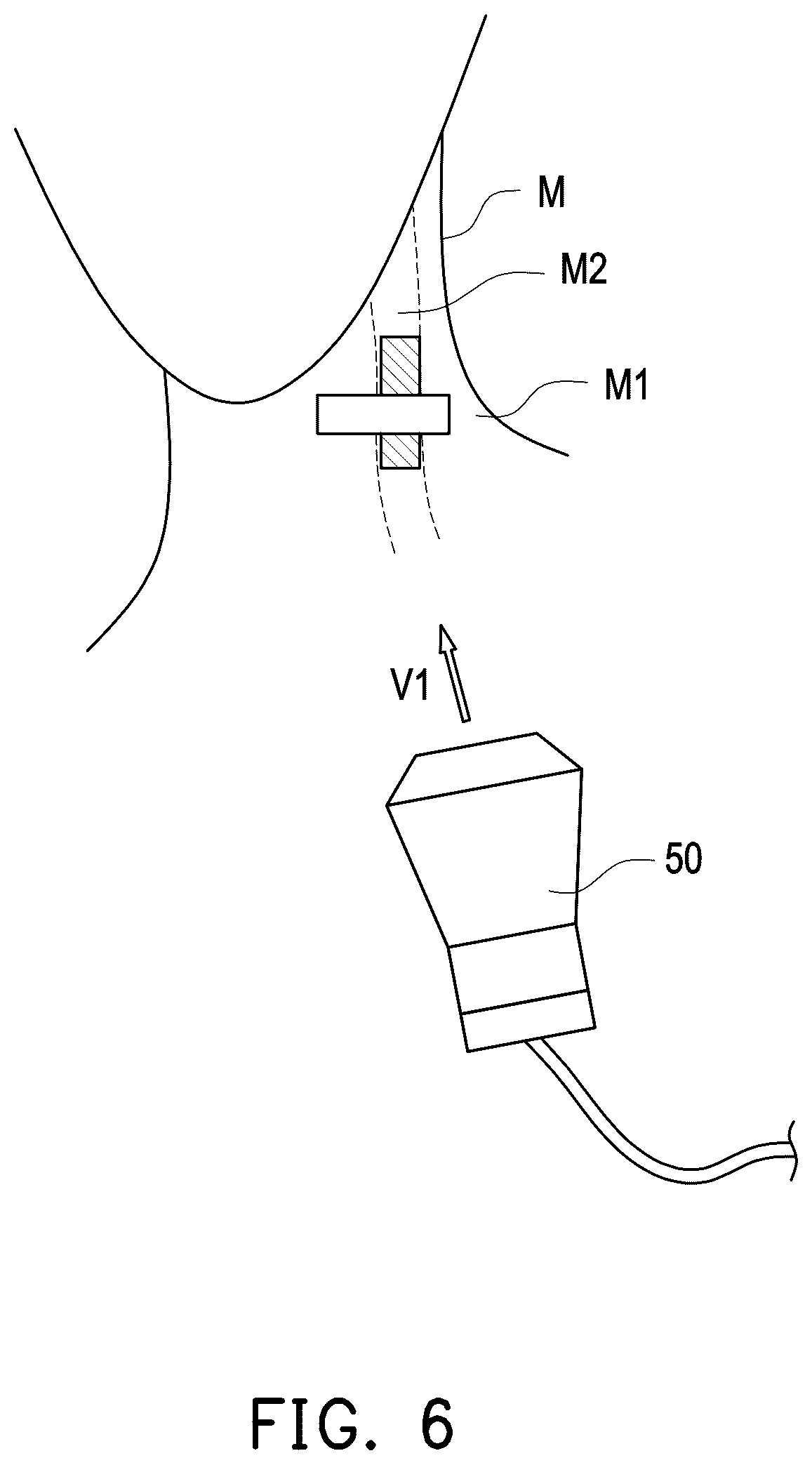 Patent US12426856 Figure 4 – Three-dimensional ultrasound image generation apparatus, three-dimensional ultrasound image generation method, and three-dimensional ultrasound image generation program