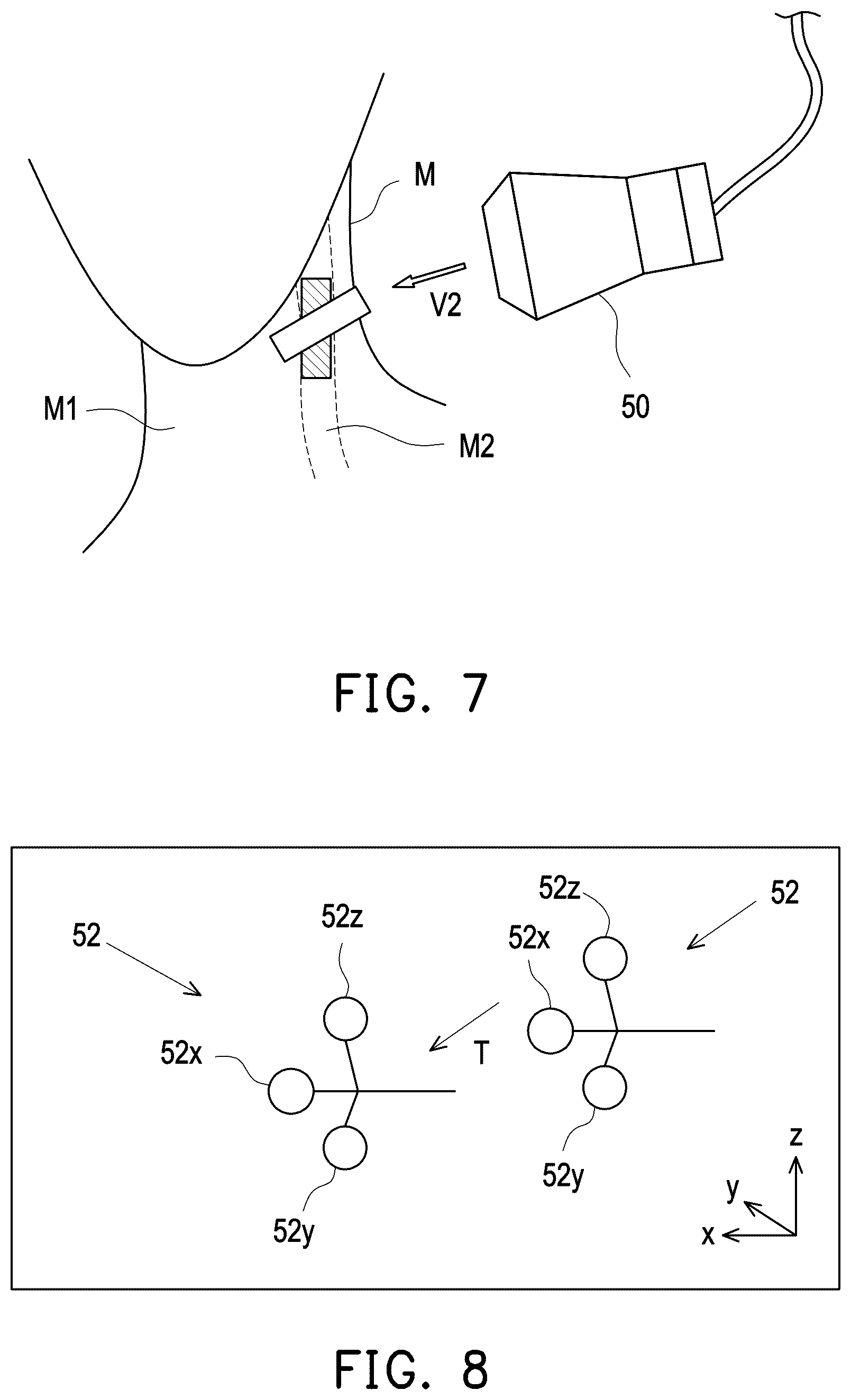 Patent US12426856 Figure 5 – Three-dimensional ultrasound image generation apparatus, three-dimensional ultrasound image generation method, and three-dimensional ultrasound image generation program