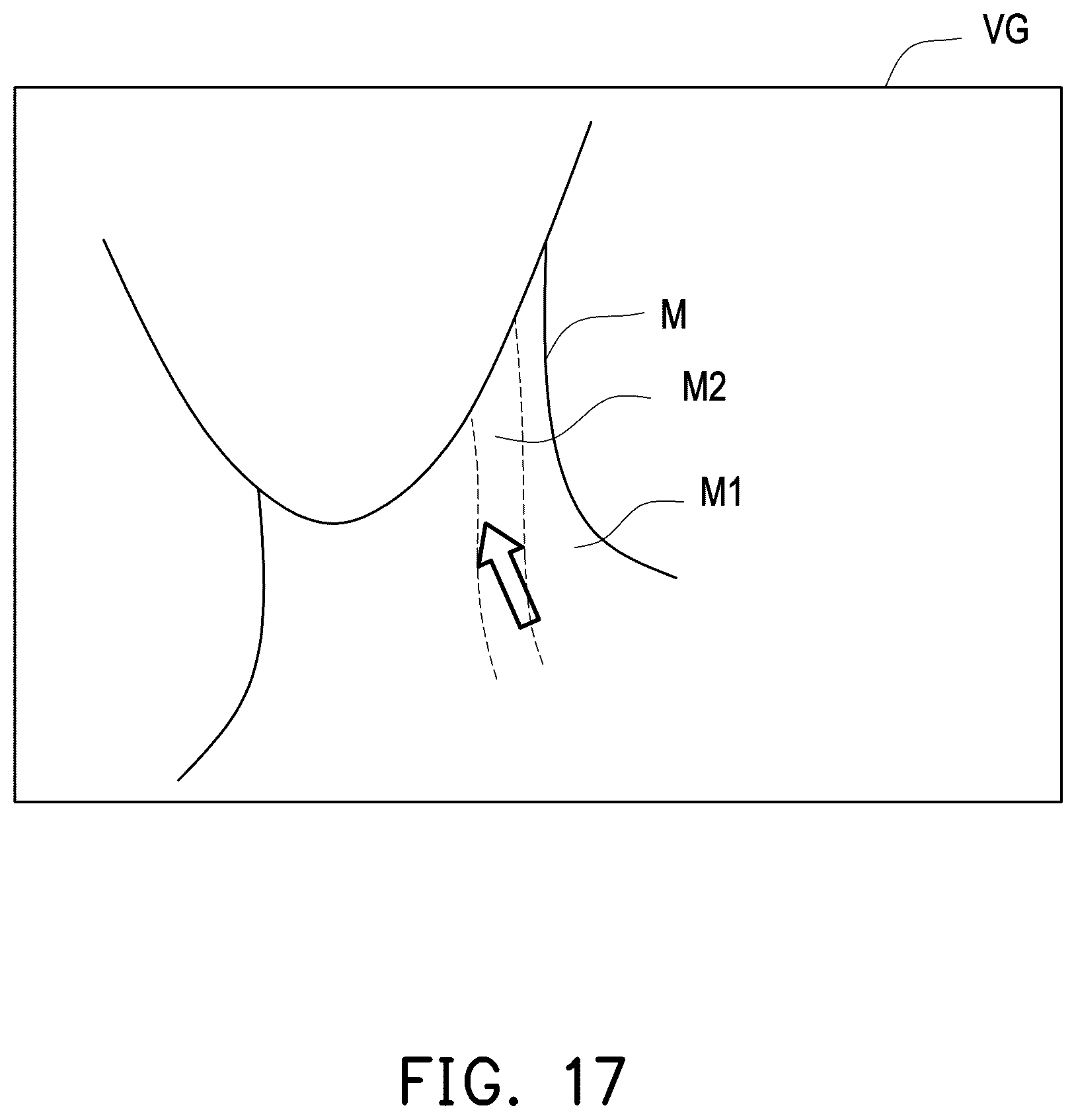 Patent US12426856 Figure 11 – Three-dimensional ultrasound image generation apparatus, three-dimensional ultrasound image generation method, and three-dimensional ultrasound image generation program