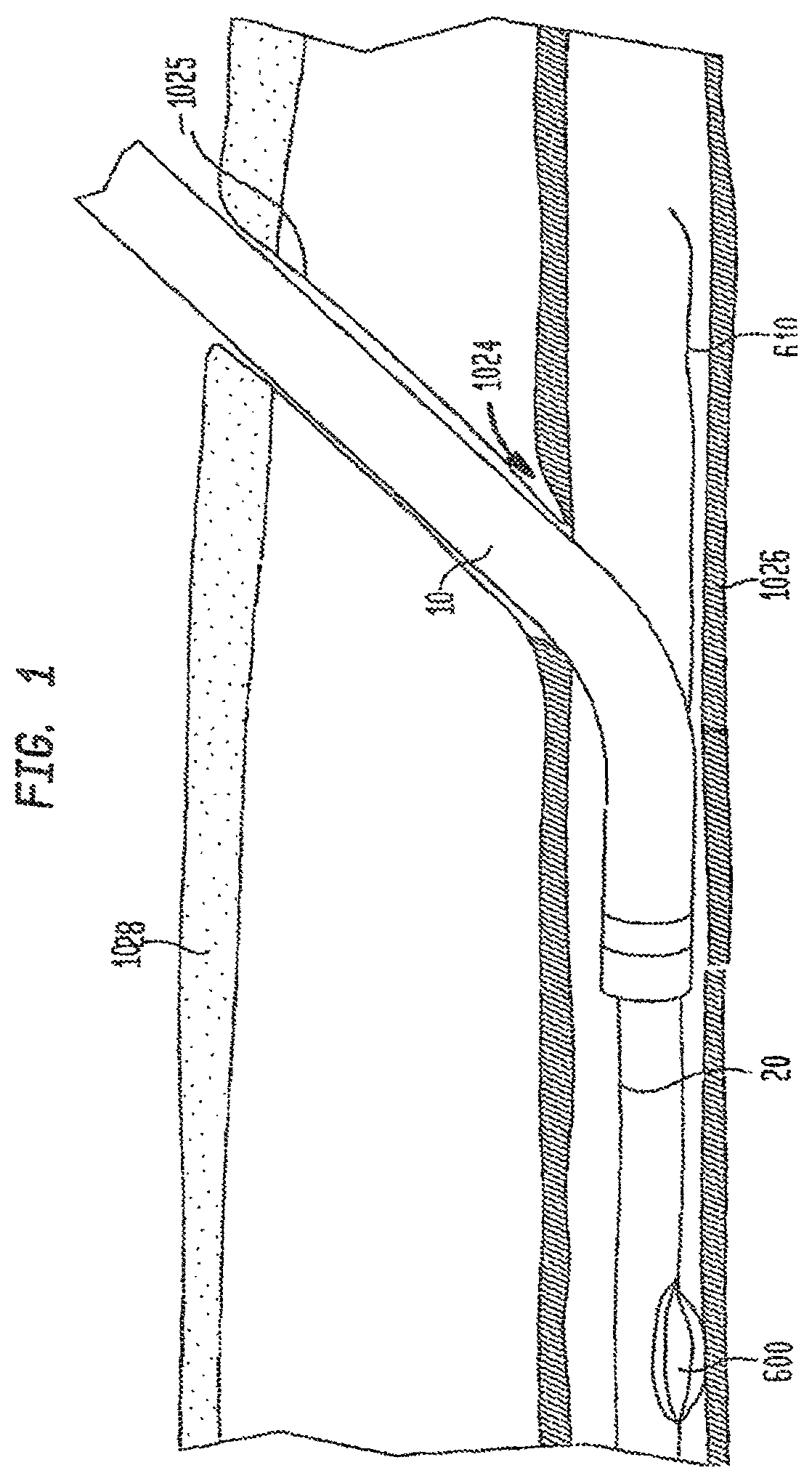 Patent US12426865 Figure 1 – Vascular closure devices and methods of use