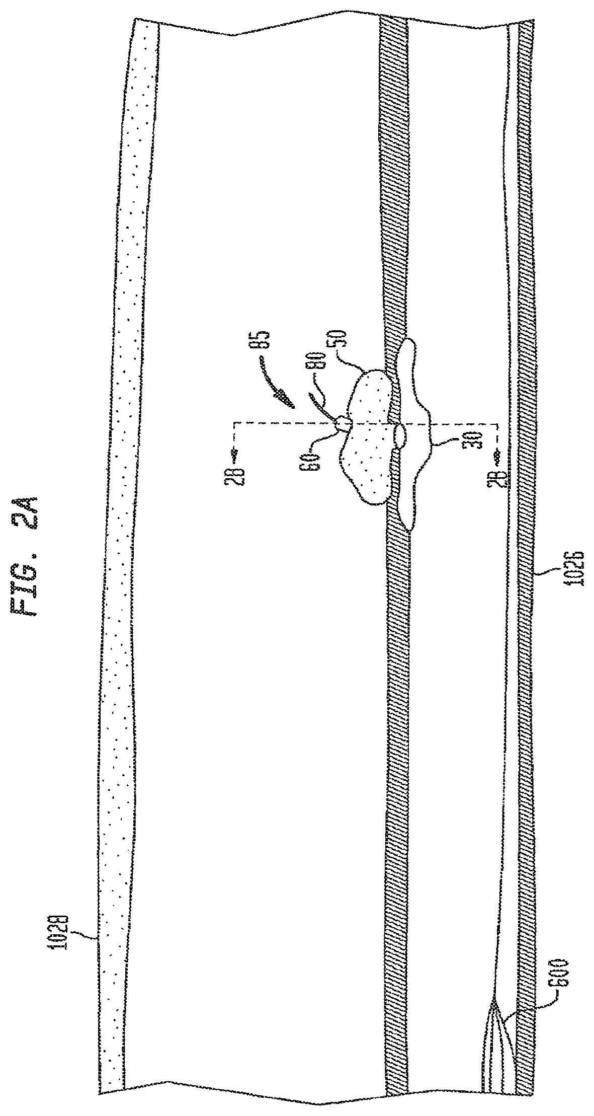 Patent US12426865 Figure 2 – Vascular closure devices and methods of use