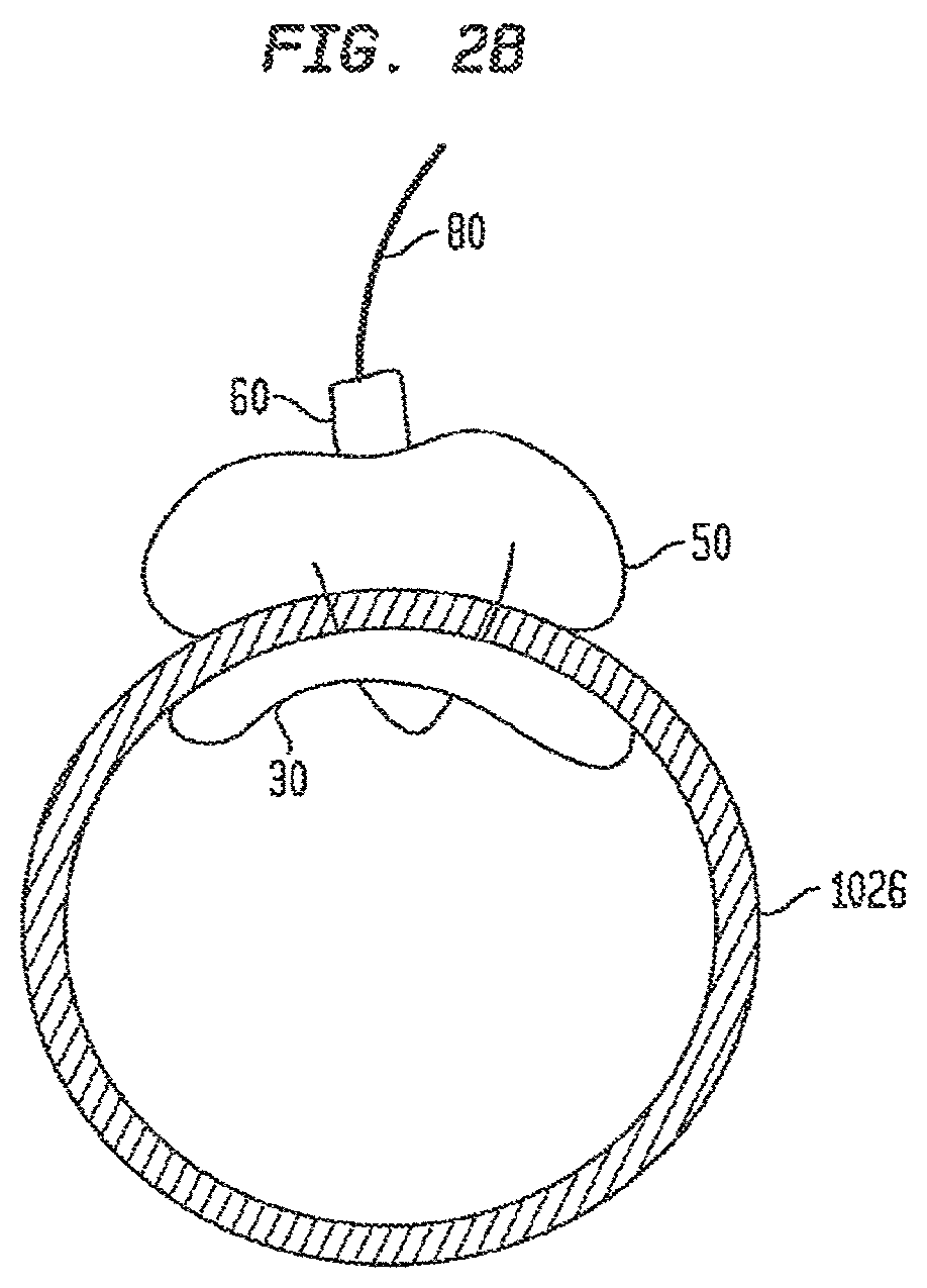 Patent US12426865 Figure 3 – Vascular closure devices and methods of use