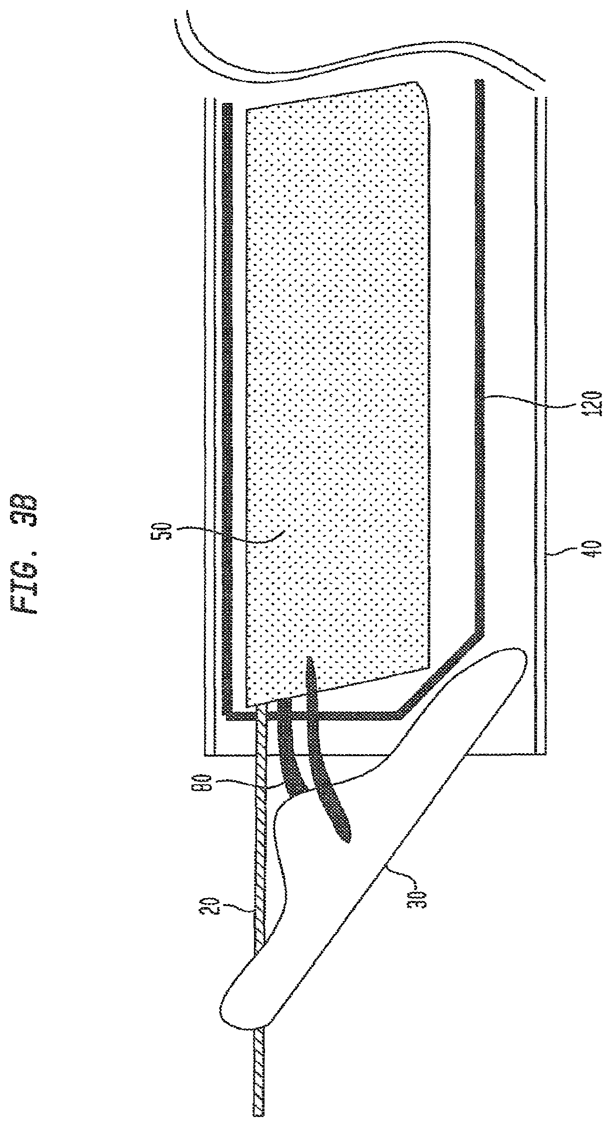 Patent US12426865 Figure 5 – Vascular closure devices and methods of use