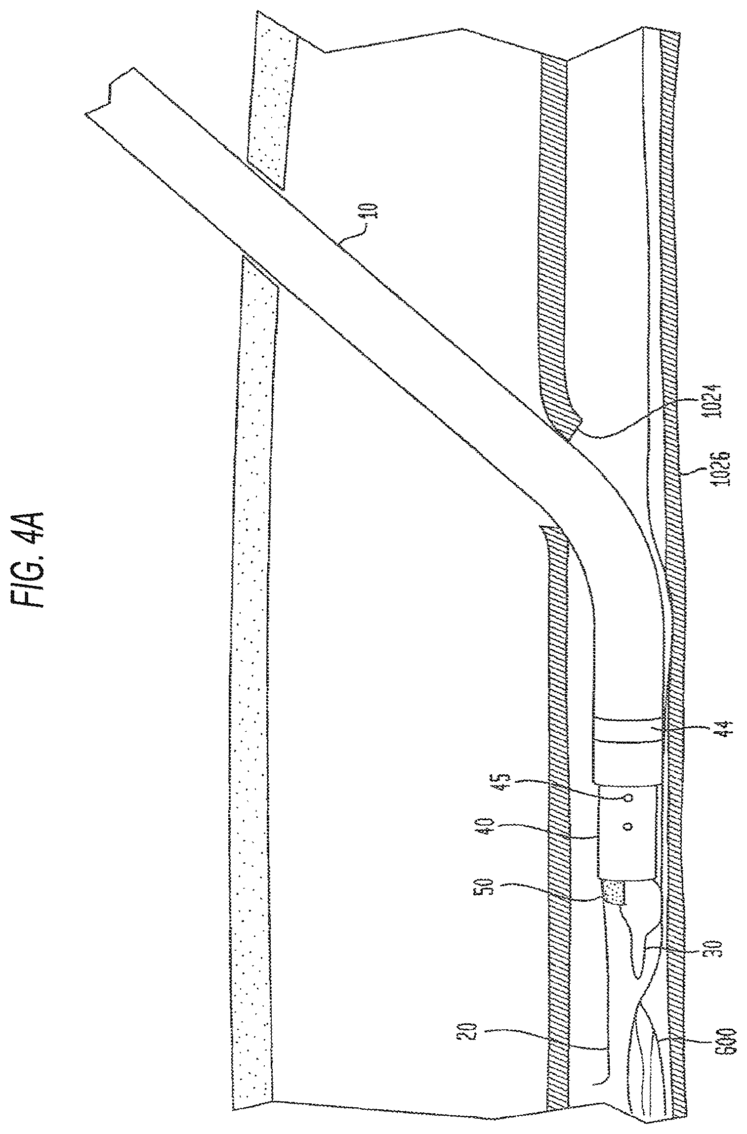 Patent US12426865 Figure 10 – Vascular closure devices and methods of use