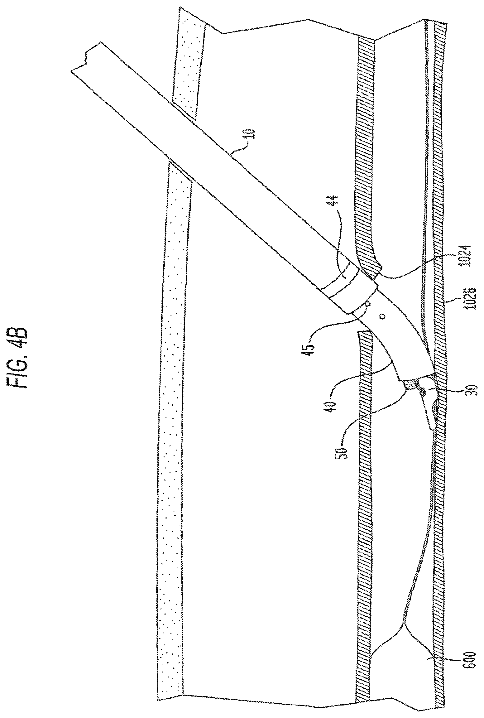 Patent US12426865 Figure 11 – Vascular closure devices and methods of use