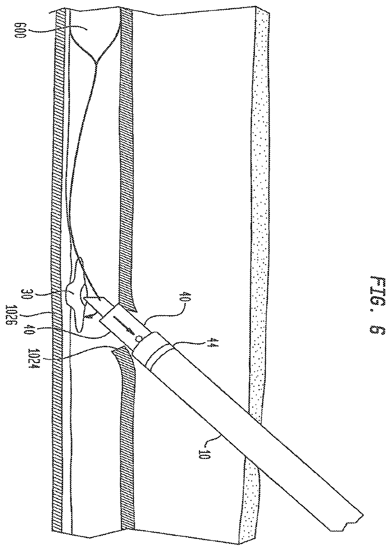 Patent US12426865 Figure 13 – Vascular closure devices and methods of use