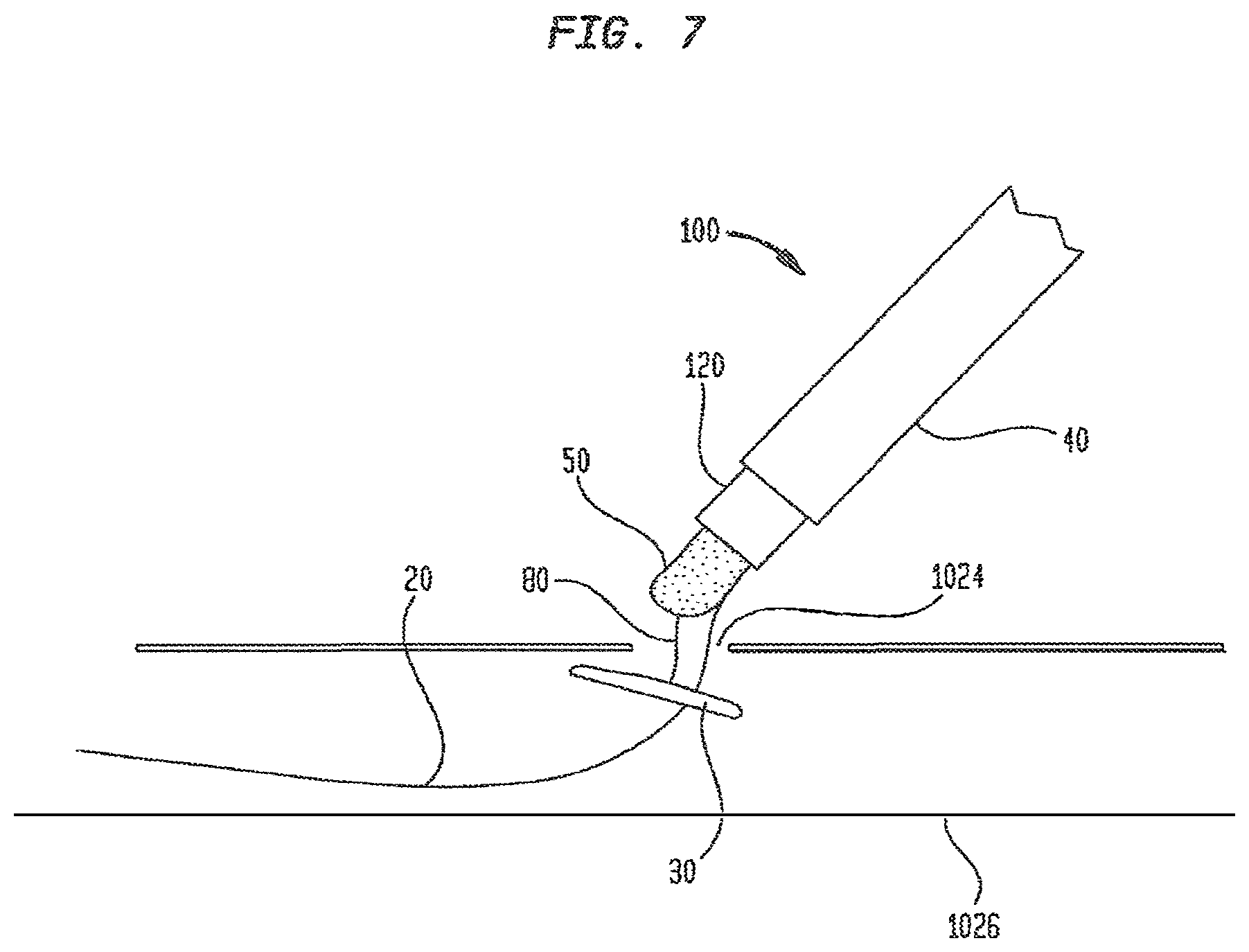 Patent US12426865 Figure 14 – Vascular closure devices and methods of use