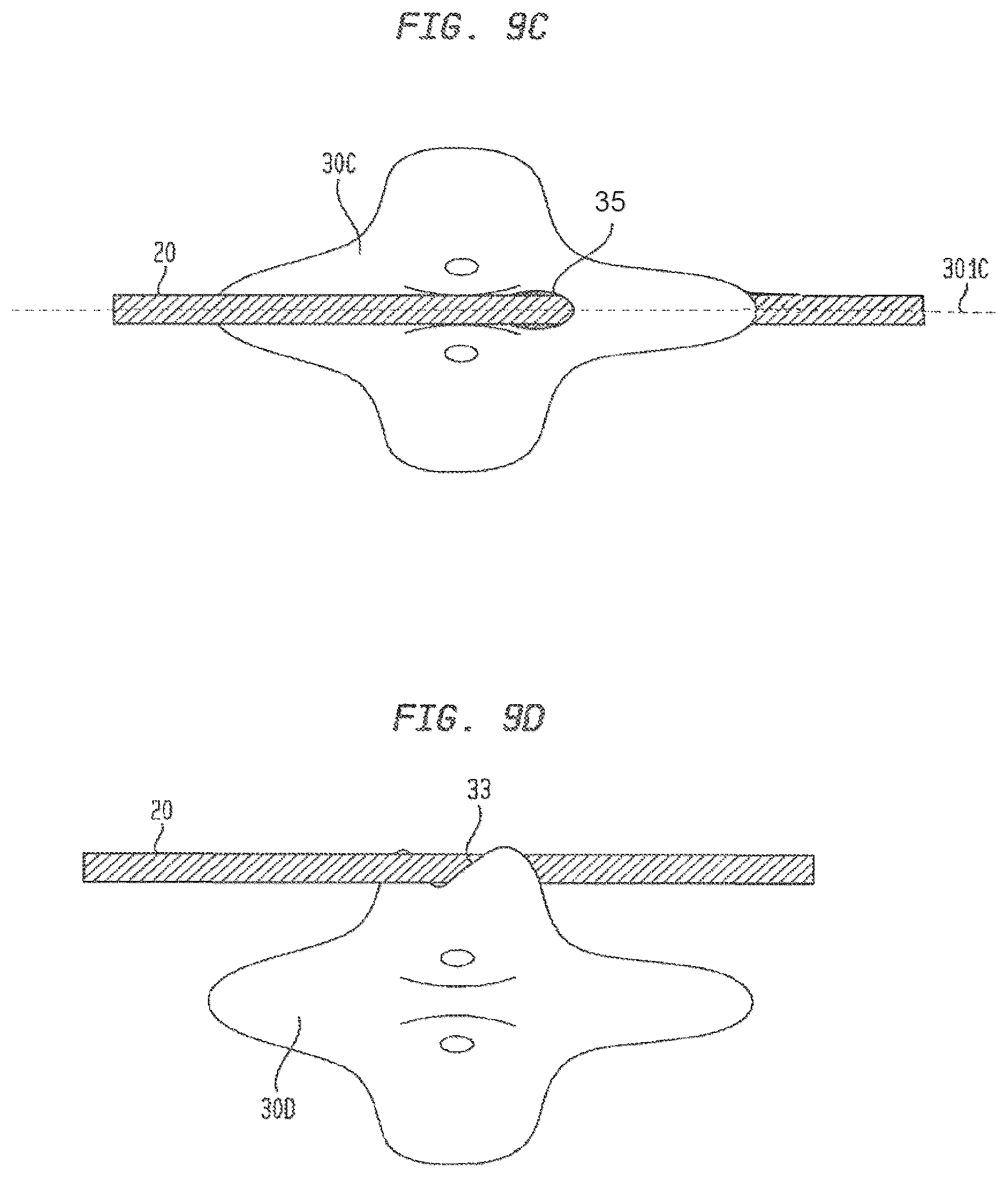 Patent US12426865 Figure 18 – Vascular closure devices and methods of use