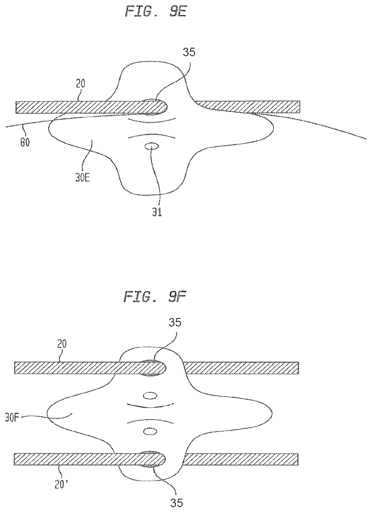 Patent US12426865 Figure 19 – Vascular closure devices and methods of use