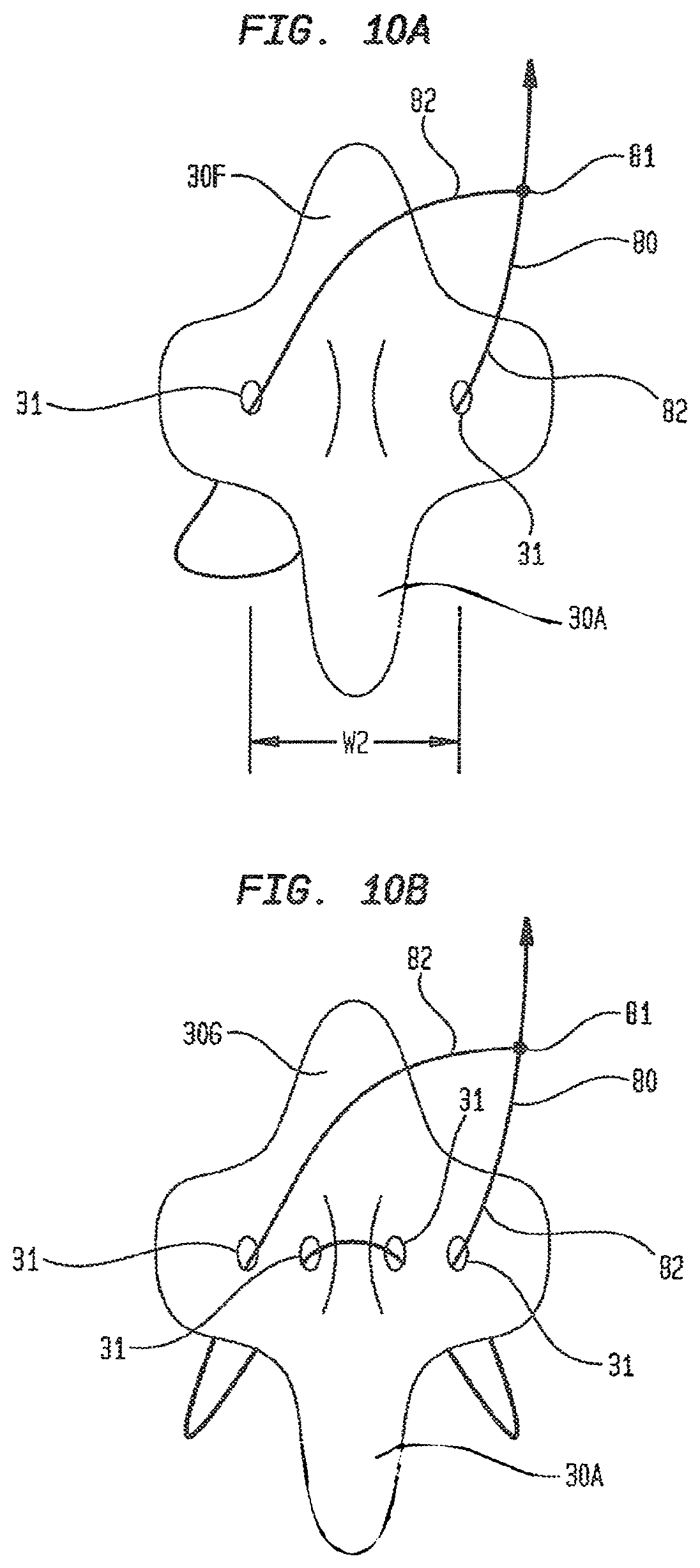 Patent US12426865 Figure 20 – Vascular closure devices and methods of use
