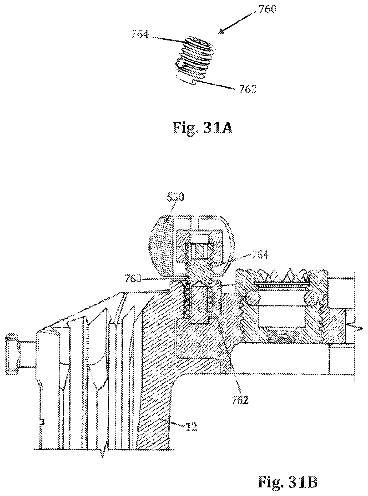 Patent US12426866 Figure 17 – Surgical access system and related methods