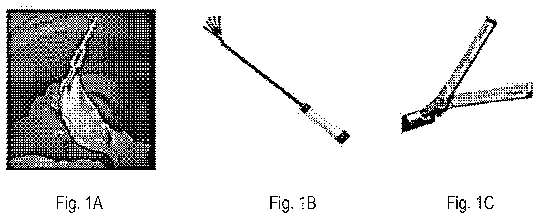 Patent US12426867 Figure 1 – Systems and methods for organ retraction and space opening