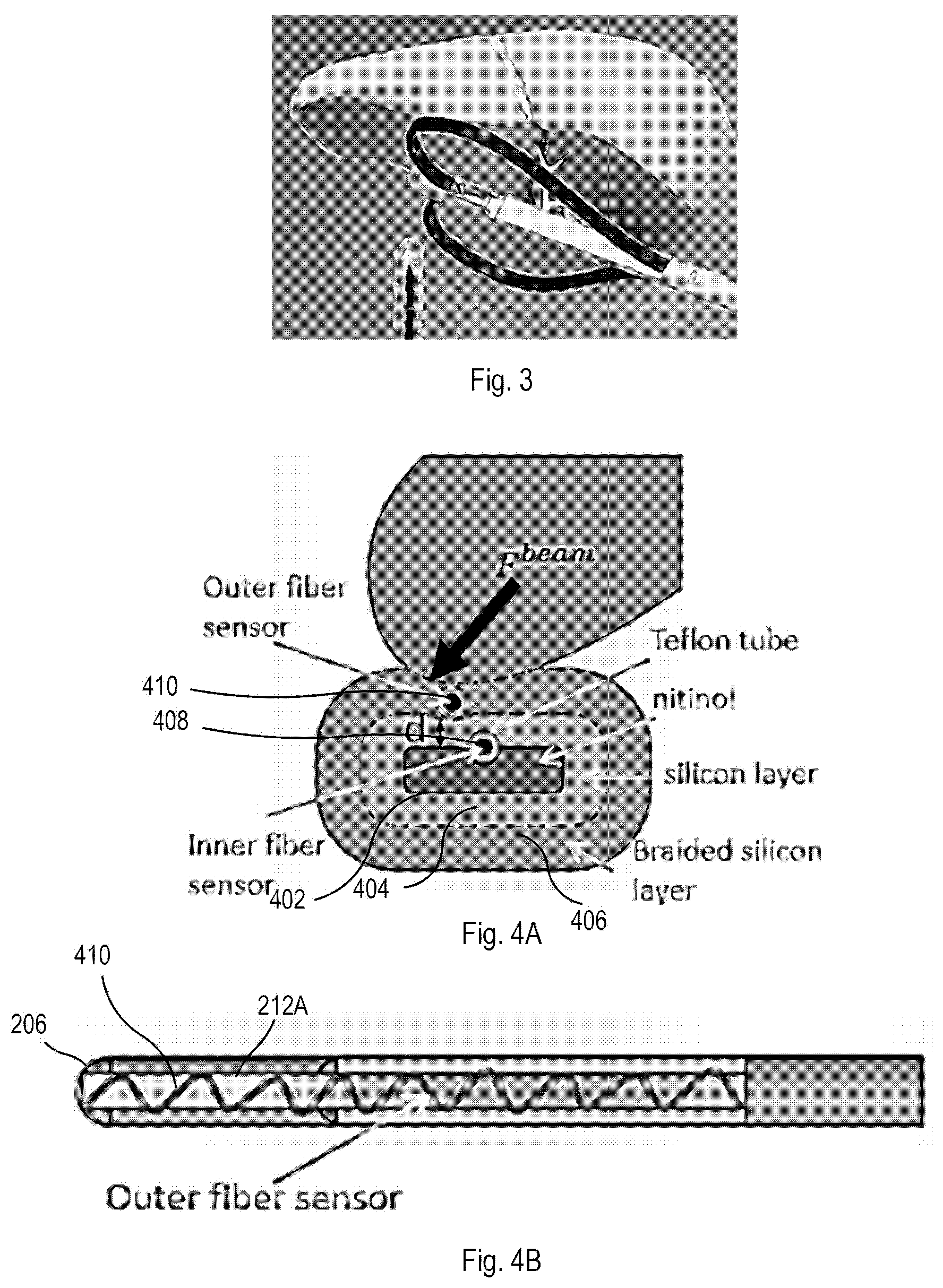 Patent US12426867 Figure 3 – Systems and methods for organ retraction and space opening