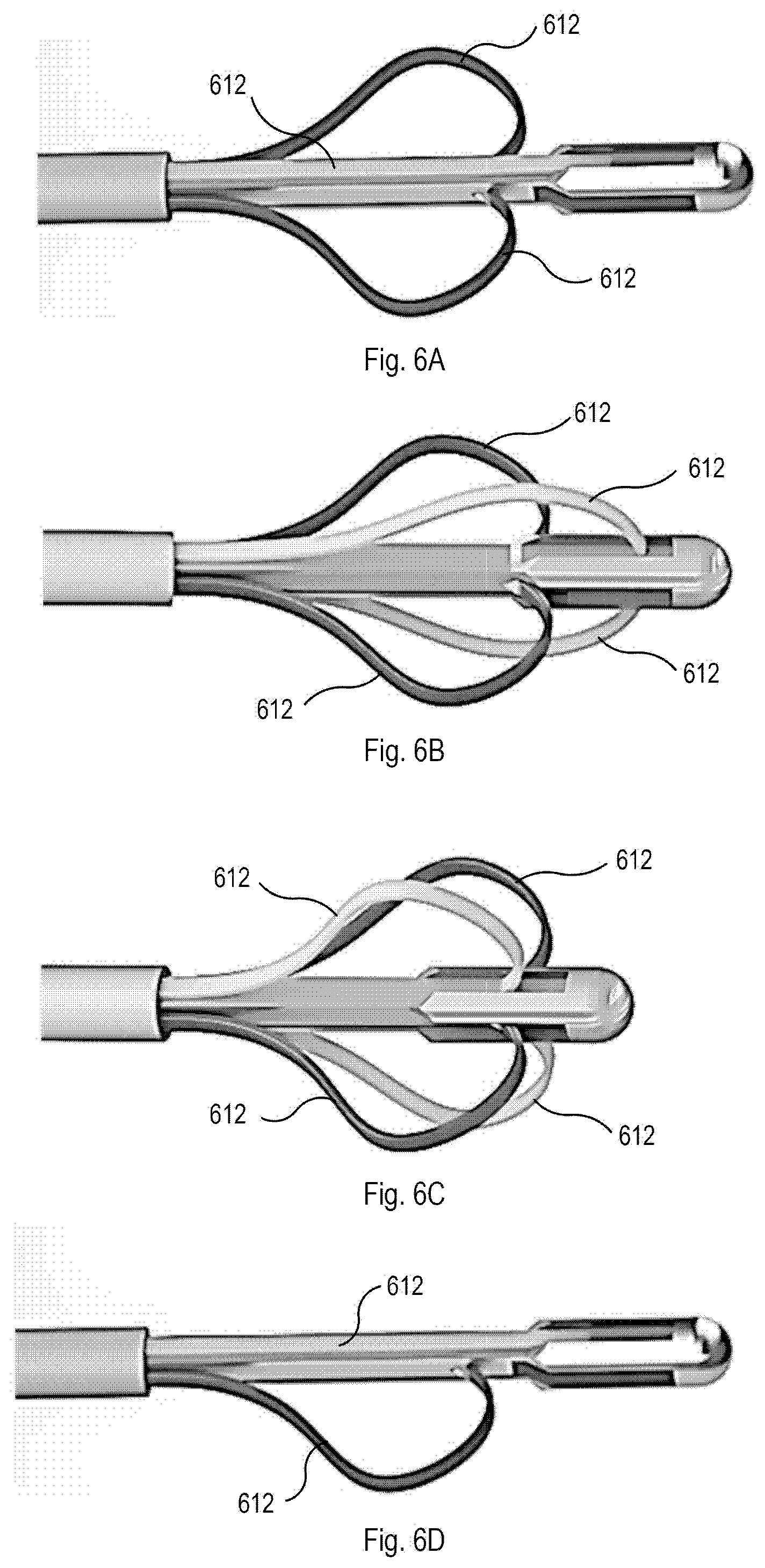 Patent US12426867 Figure 5 – Systems and methods for organ retraction and space opening