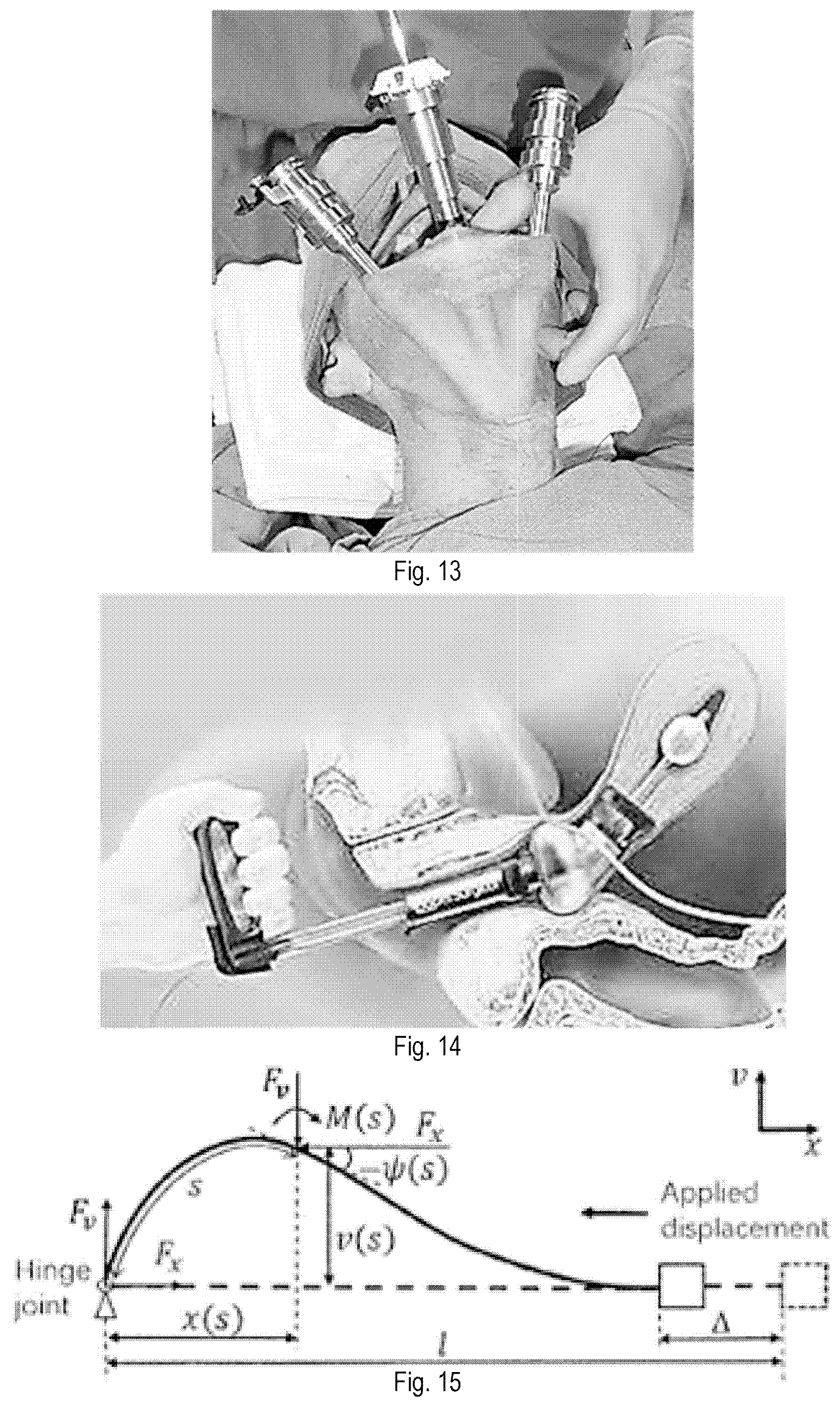 Patent US12426867 Figure 11 – Systems and methods for organ retraction and space opening