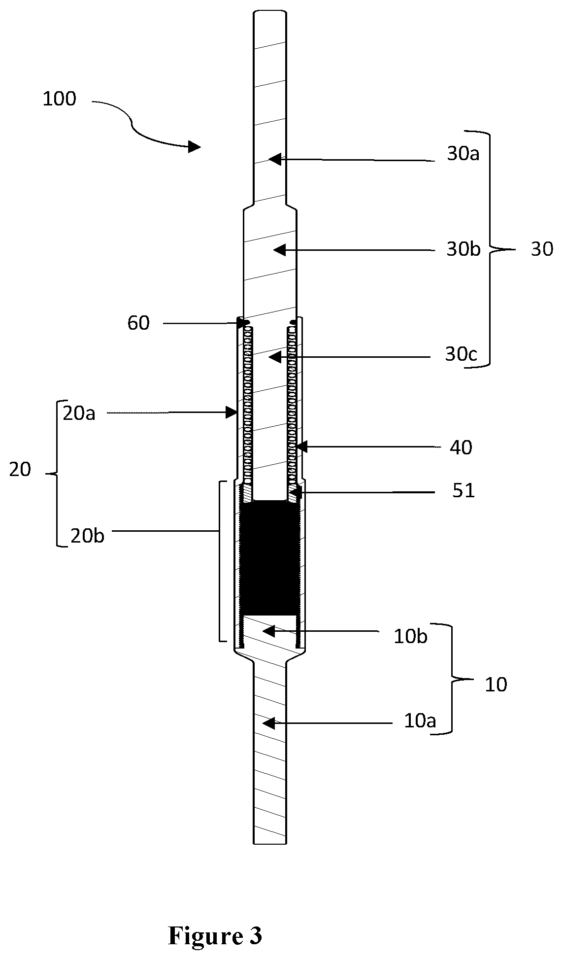 Patent US12426869 Figure 3 – Constant distraction force driven self actuating growing rod systems