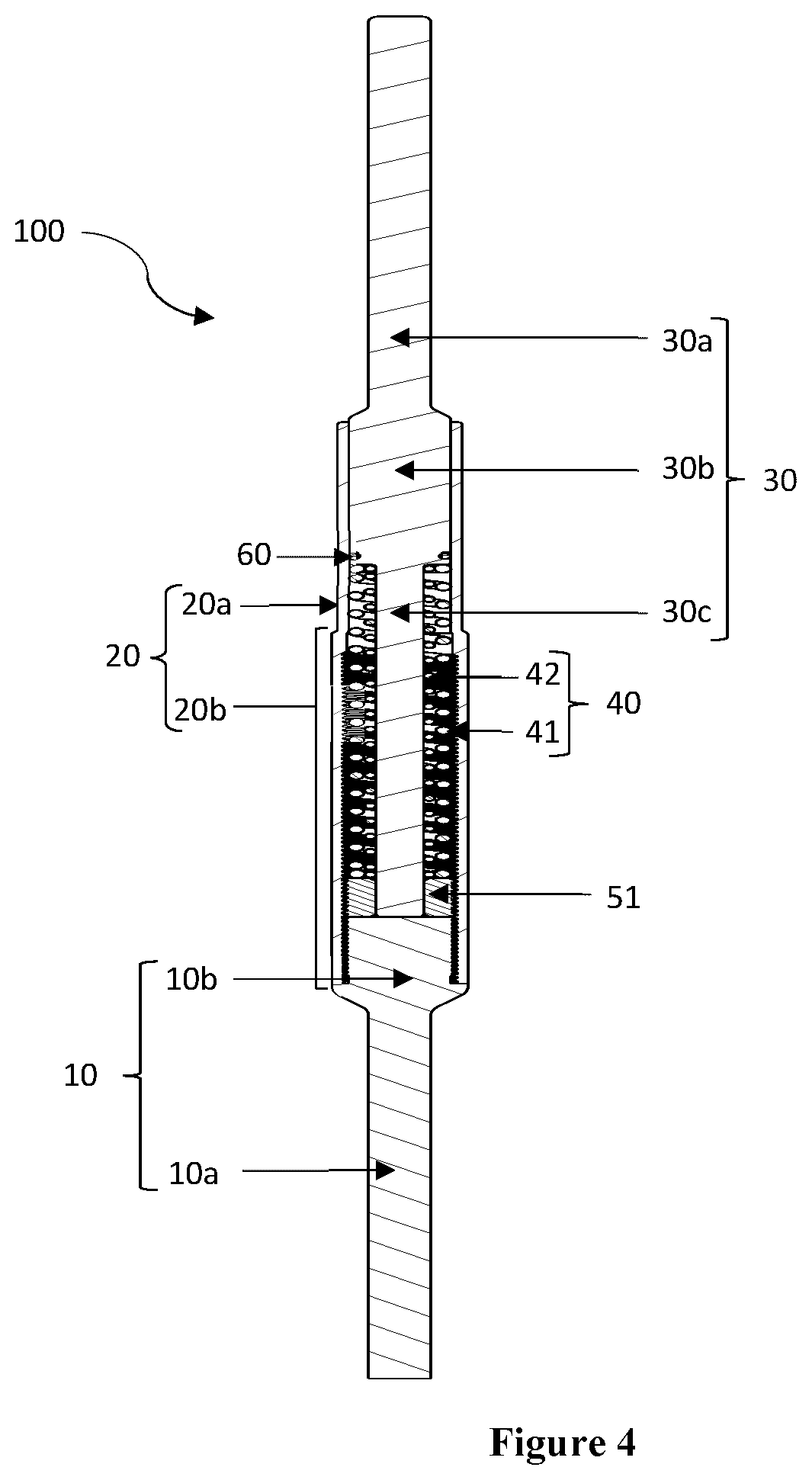Patent US12426869 Figure 4 – Constant distraction force driven self actuating growing rod systems