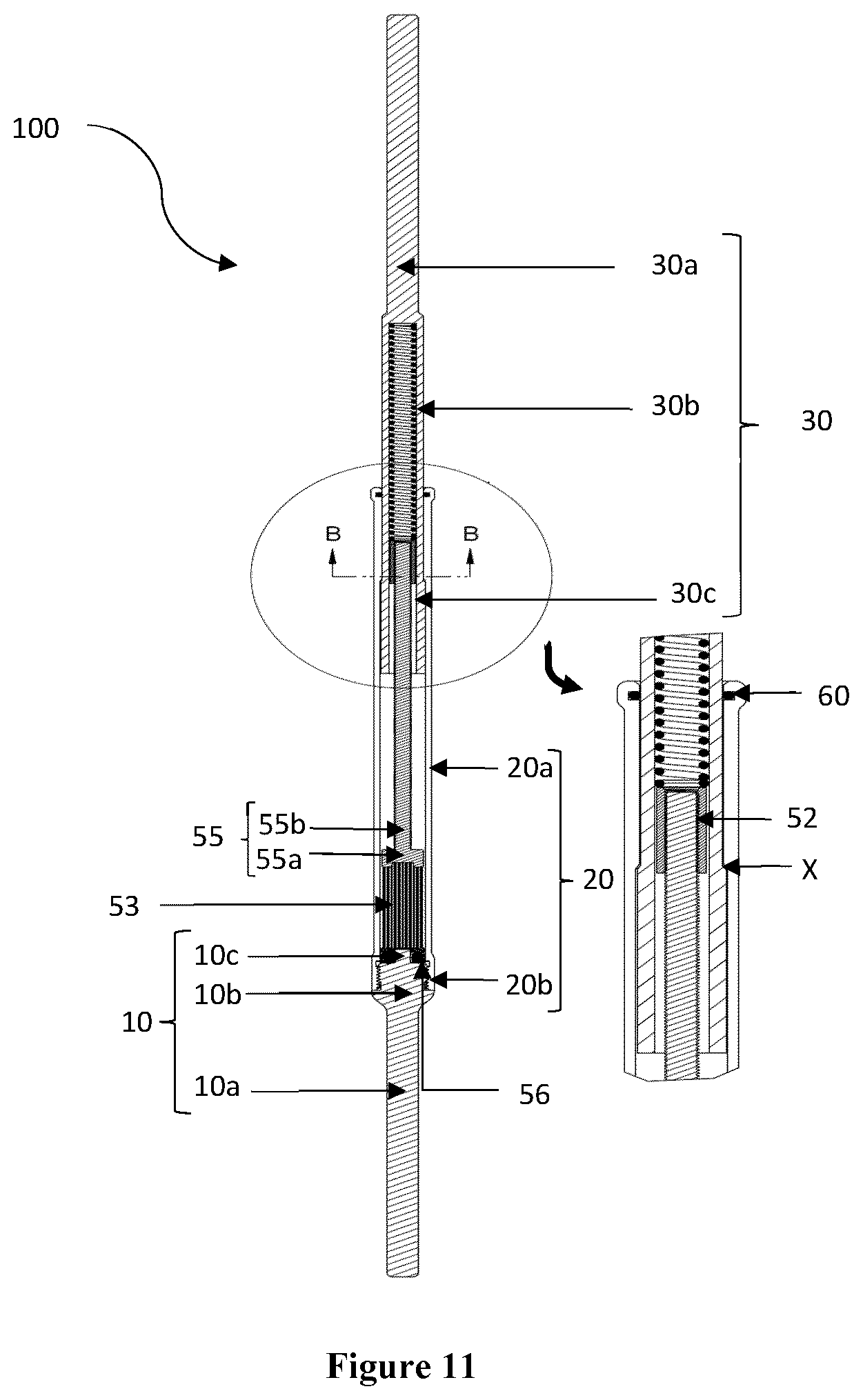 Patent US12426869 Figure 11 – Constant distraction force driven self actuating growing rod systems