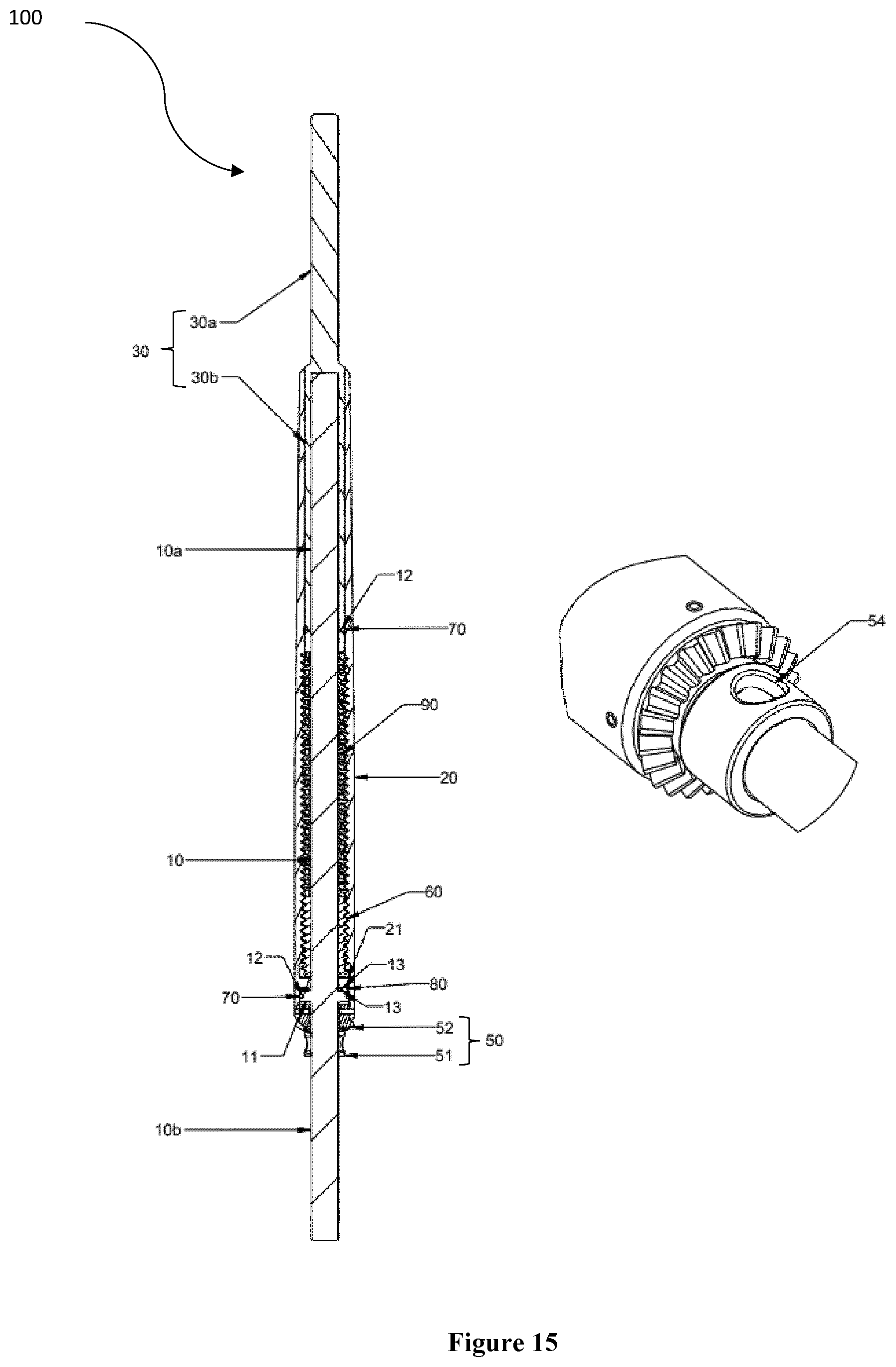 Patent US12426869 Figure 15 – Constant distraction force driven self actuating growing rod systems