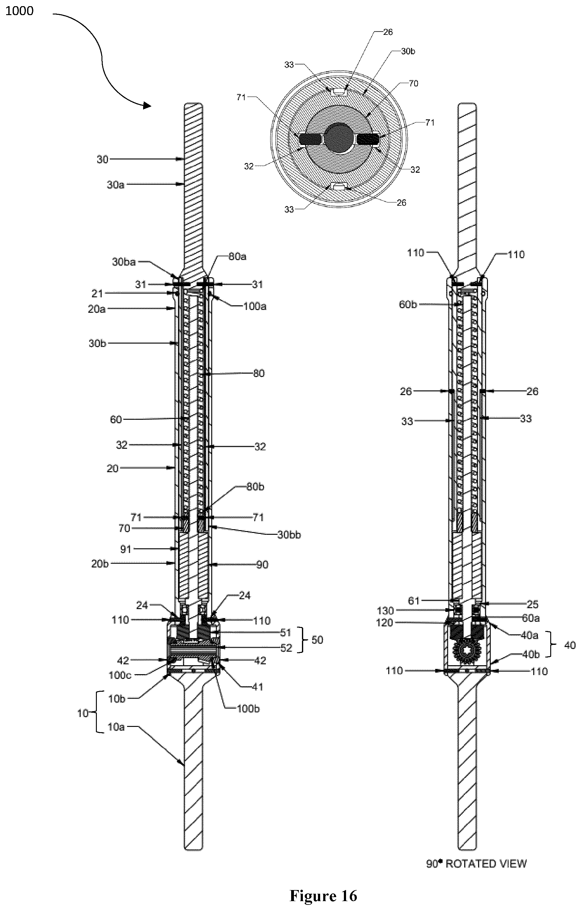 Patent US12426869 Figure 16 – Constant distraction force driven self actuating growing rod systems