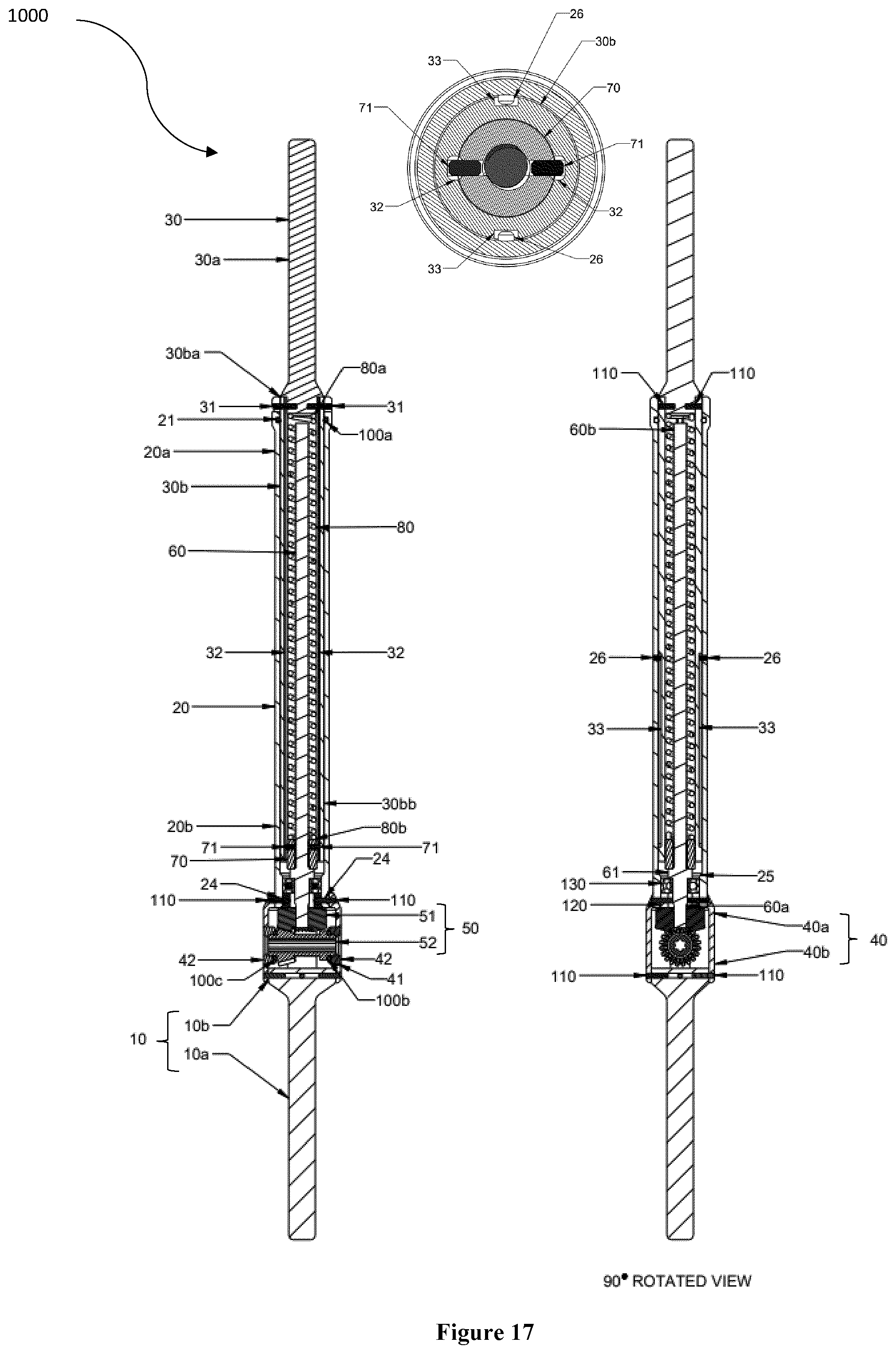 Patent US12426869 Figure 17 – Constant distraction force driven self actuating growing rod systems
