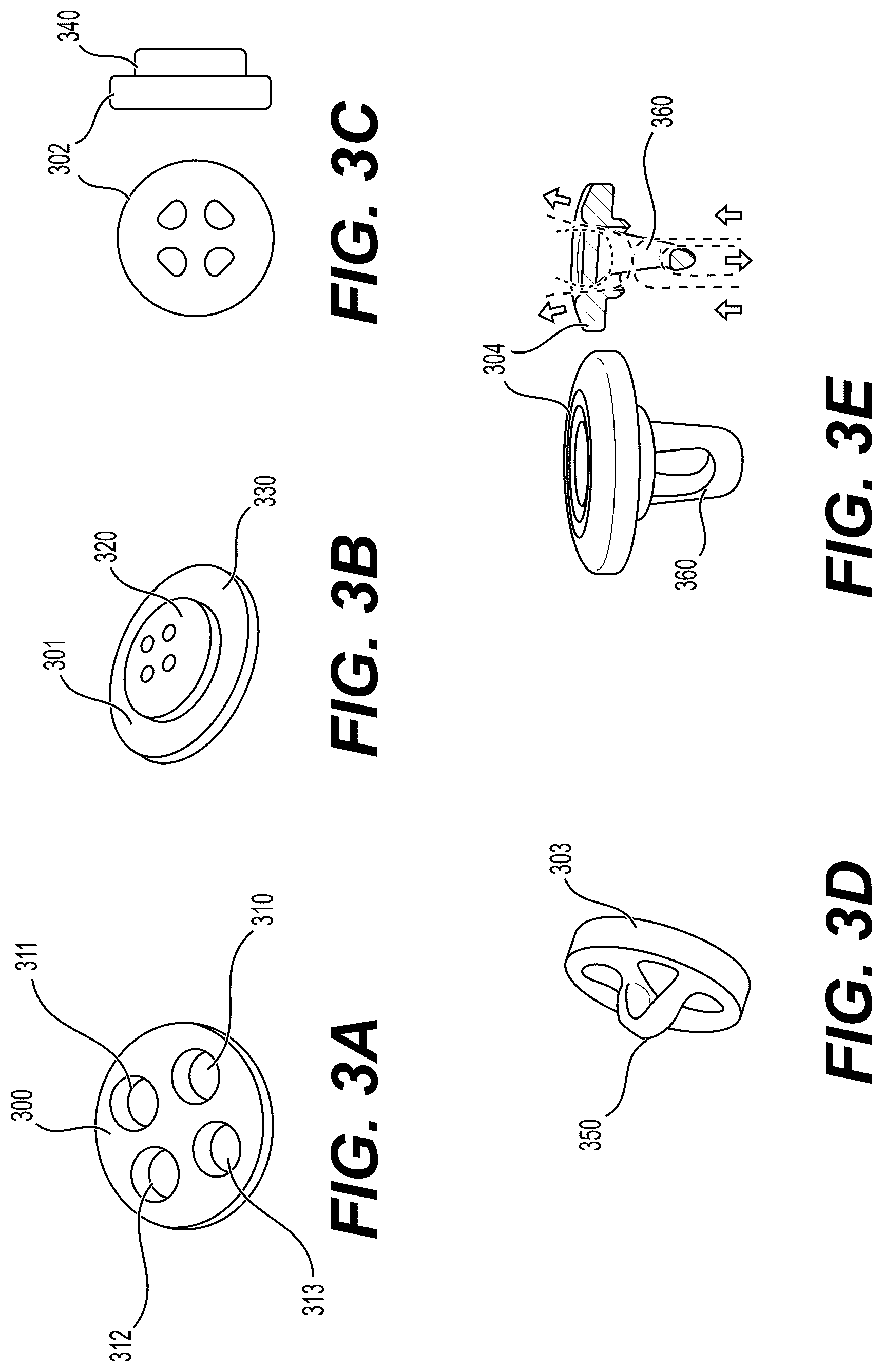 Patent US12426871 Figure 3 – Systems, devices and methods for implanting suture buttons