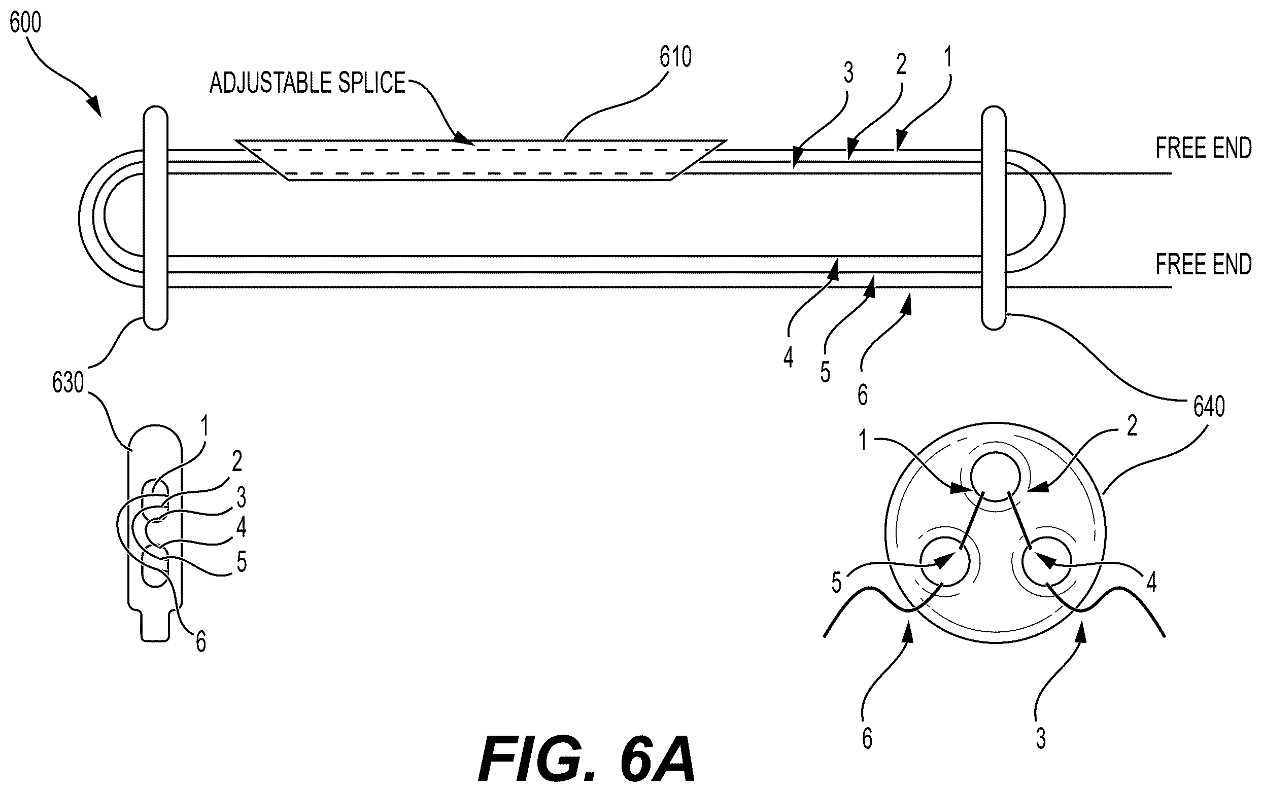 Patent US12426871 Figure 7 – Systems, devices and methods for implanting suture buttons