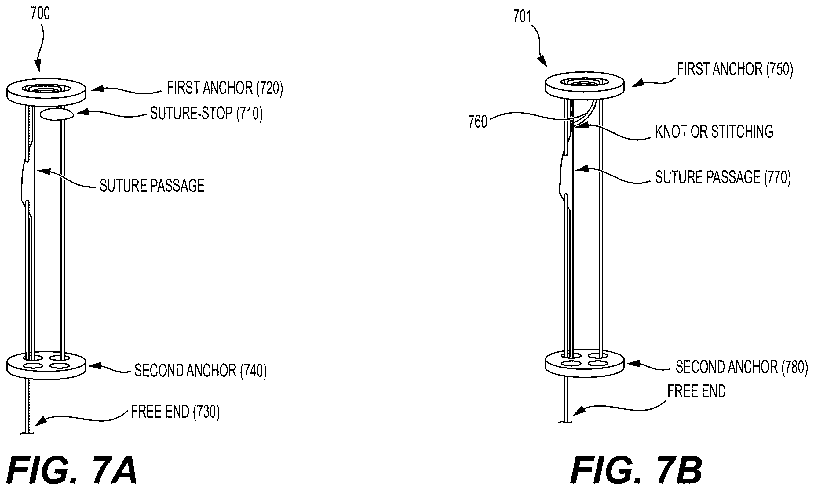 Patent US12426871 Figure 9 – Systems, devices and methods for implanting suture buttons