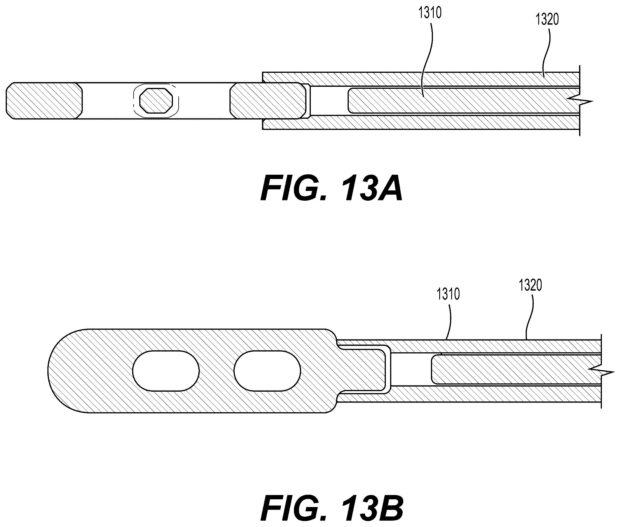 Patent US12426871 Figure 13 – Systems, devices and methods for implanting suture buttons