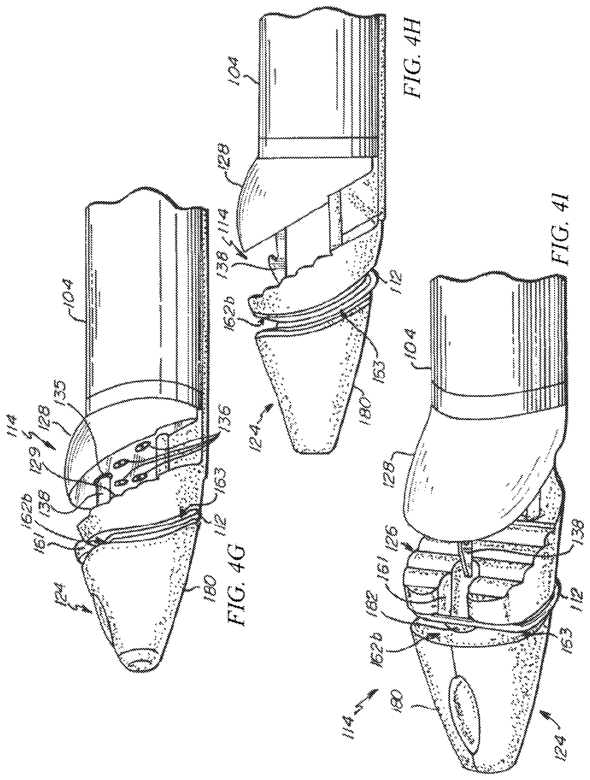 Patent US12426874 Figure 5 – Minimally invasive repair of a valve leaflet in a beating heart