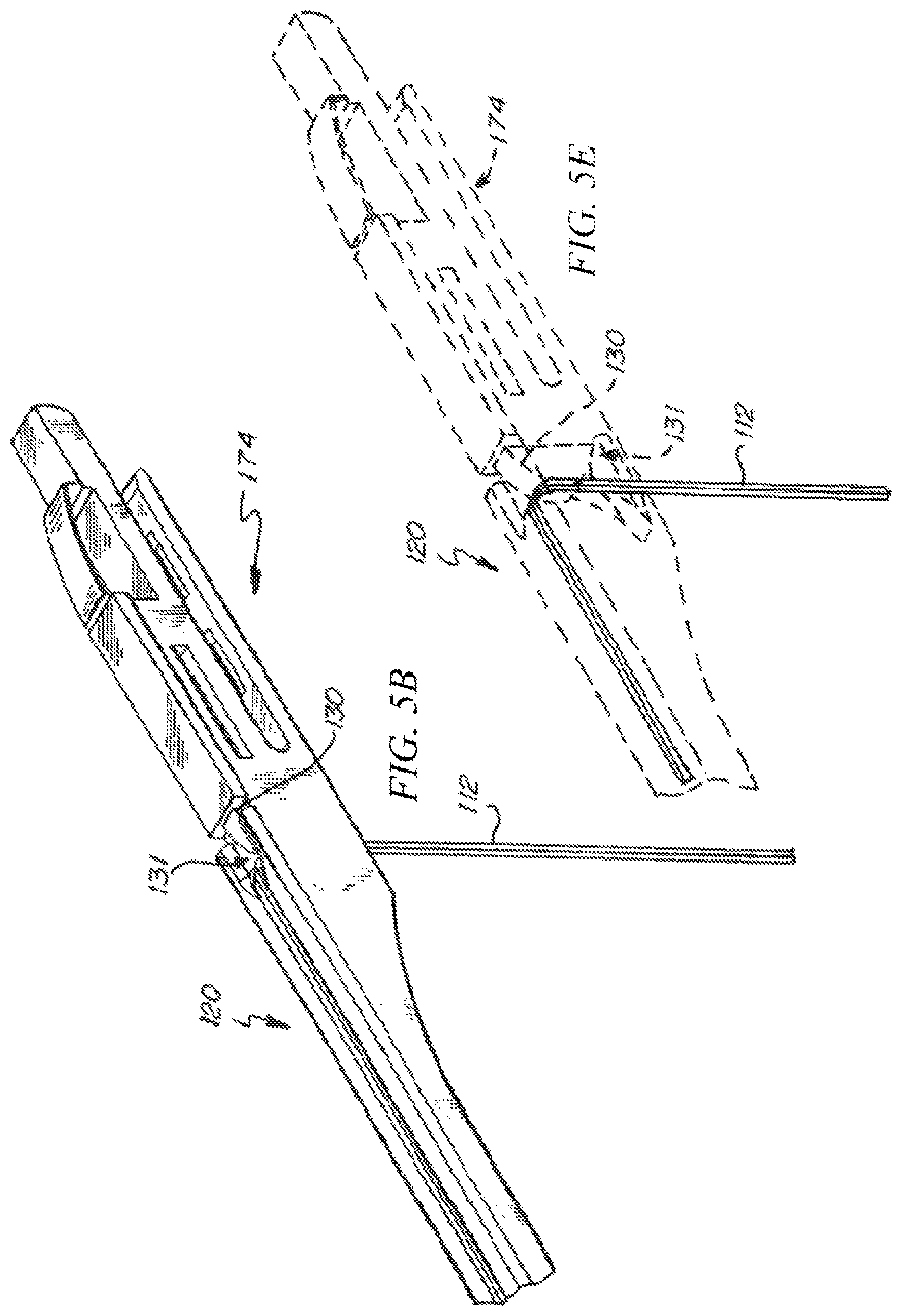 Patent US12426874 Figure 8 – Minimally invasive repair of a valve leaflet in a beating heart