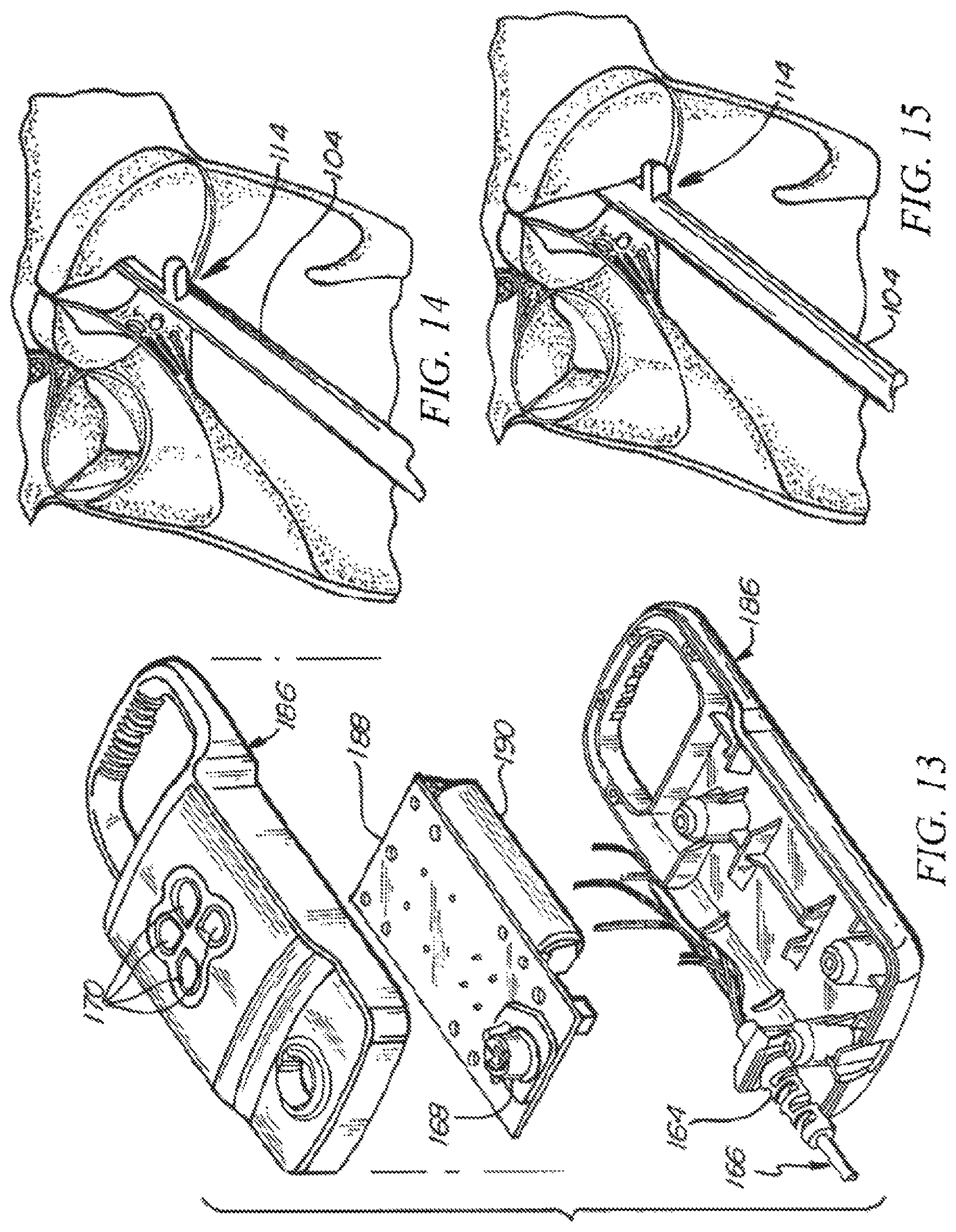 Patent US12426874 Figure 14 – Minimally invasive repair of a valve leaflet in a beating heart