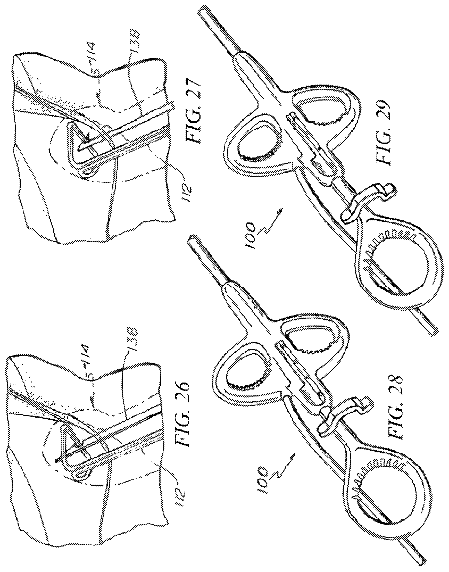 Patent US12426874 Figure 17 – Minimally invasive repair of a valve leaflet in a beating heart