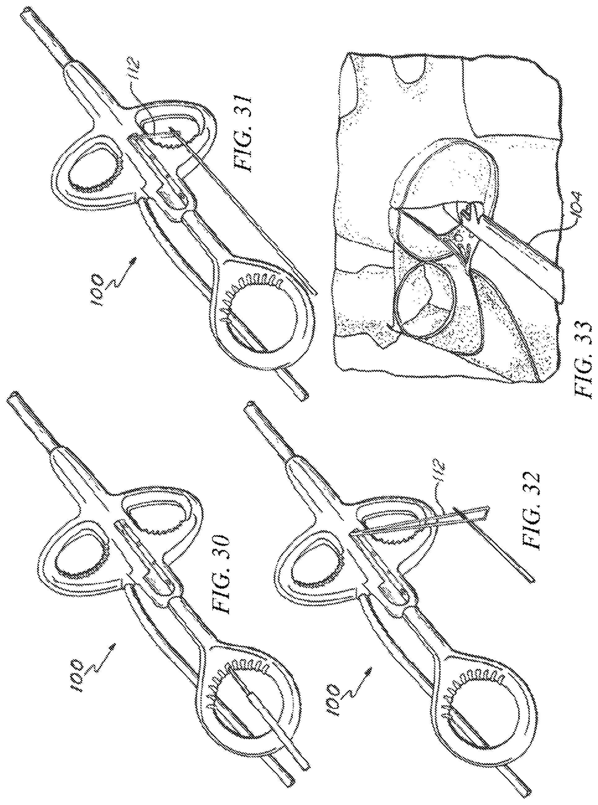 Patent US12426874 Figure 18 – Minimally invasive repair of a valve leaflet in a beating heart