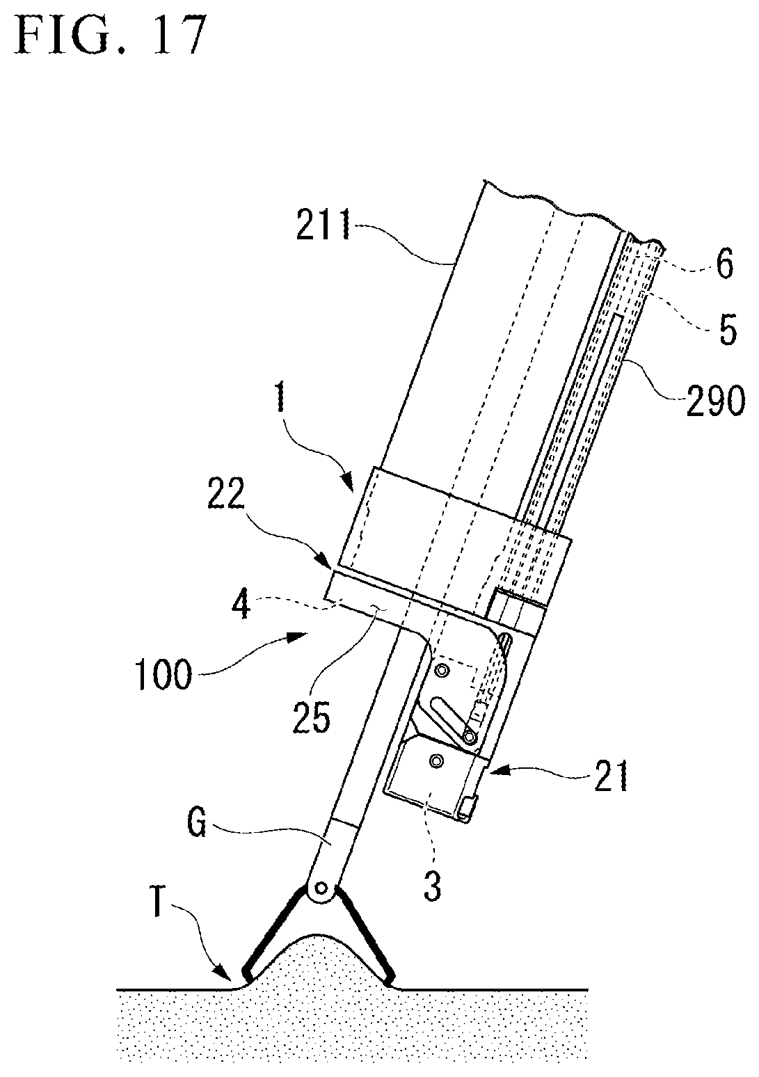 Patent US12426878 Figure 11 – Medical stapler and suturing method