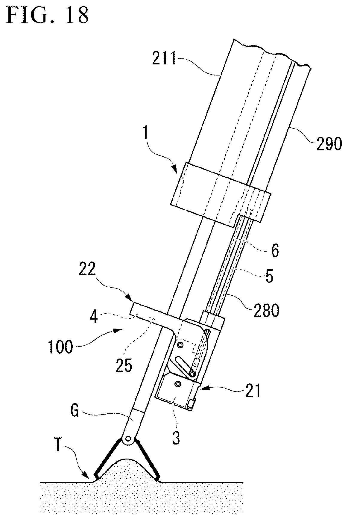 Patent US12426878 Figure 12 – Medical stapler and suturing method